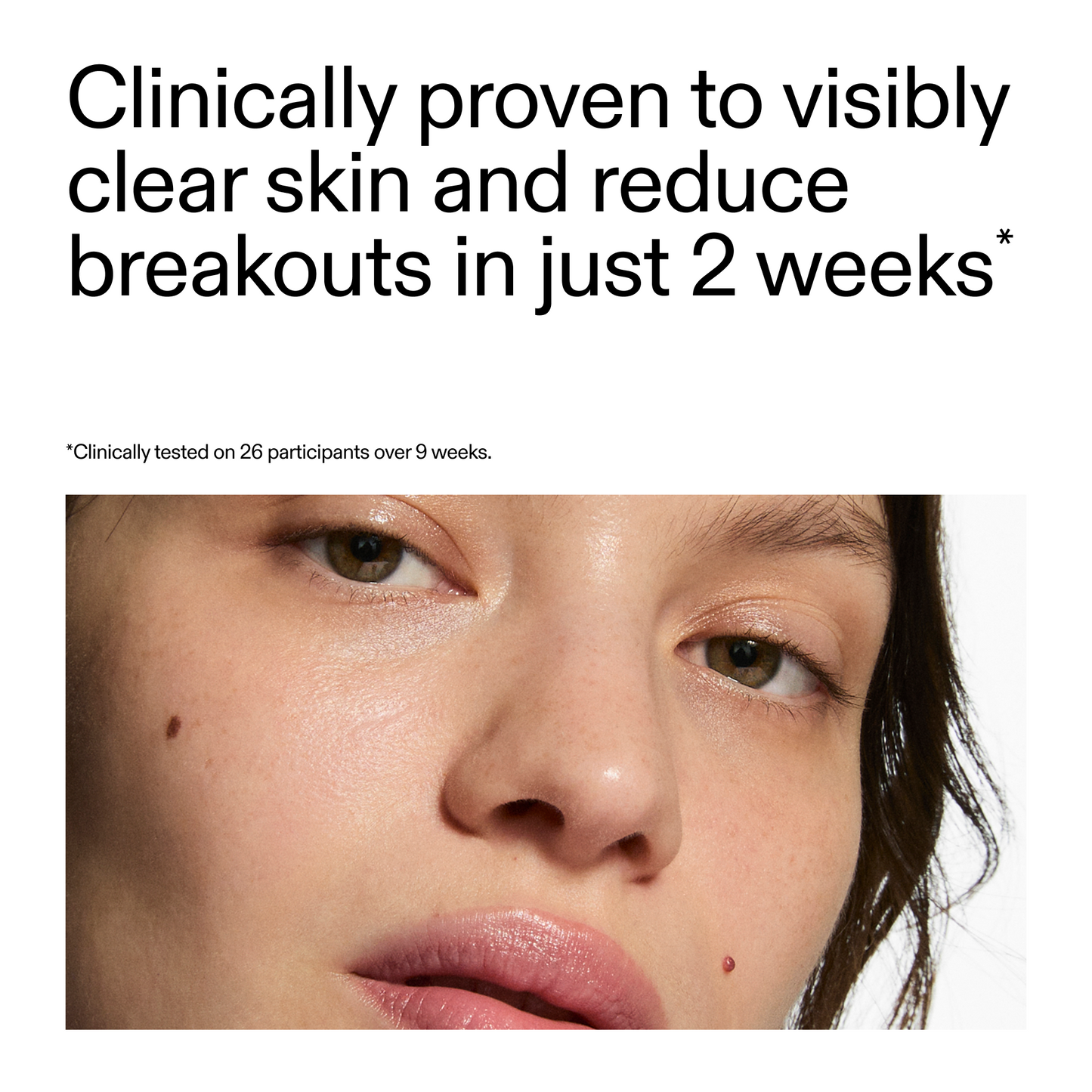 360-acne-clearing-duo-e3 360_Serum_Key_Claim.png