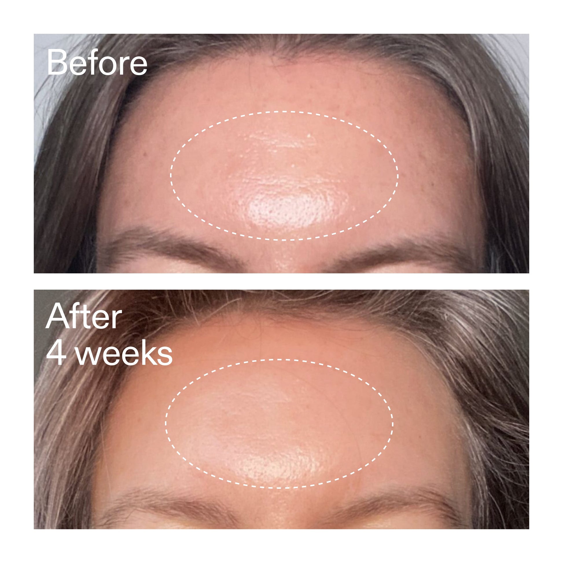 advanced-0-2-retinal-serum-duo-q5 AdvancedRetinal_BeforeAfter1_2000x2000_4e9c798a-f30e-45b8-a34a-7c4740f2f2cb.jpg