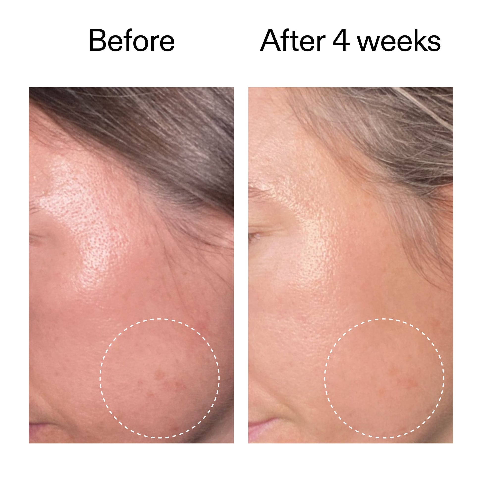 advanced-0-2-retinal-serum-duo-q5 AdvancedRetinal_BeforeAfter2__2000x2000_8ef75542-2316-4814-81ee-0f66a85912bc.jpg