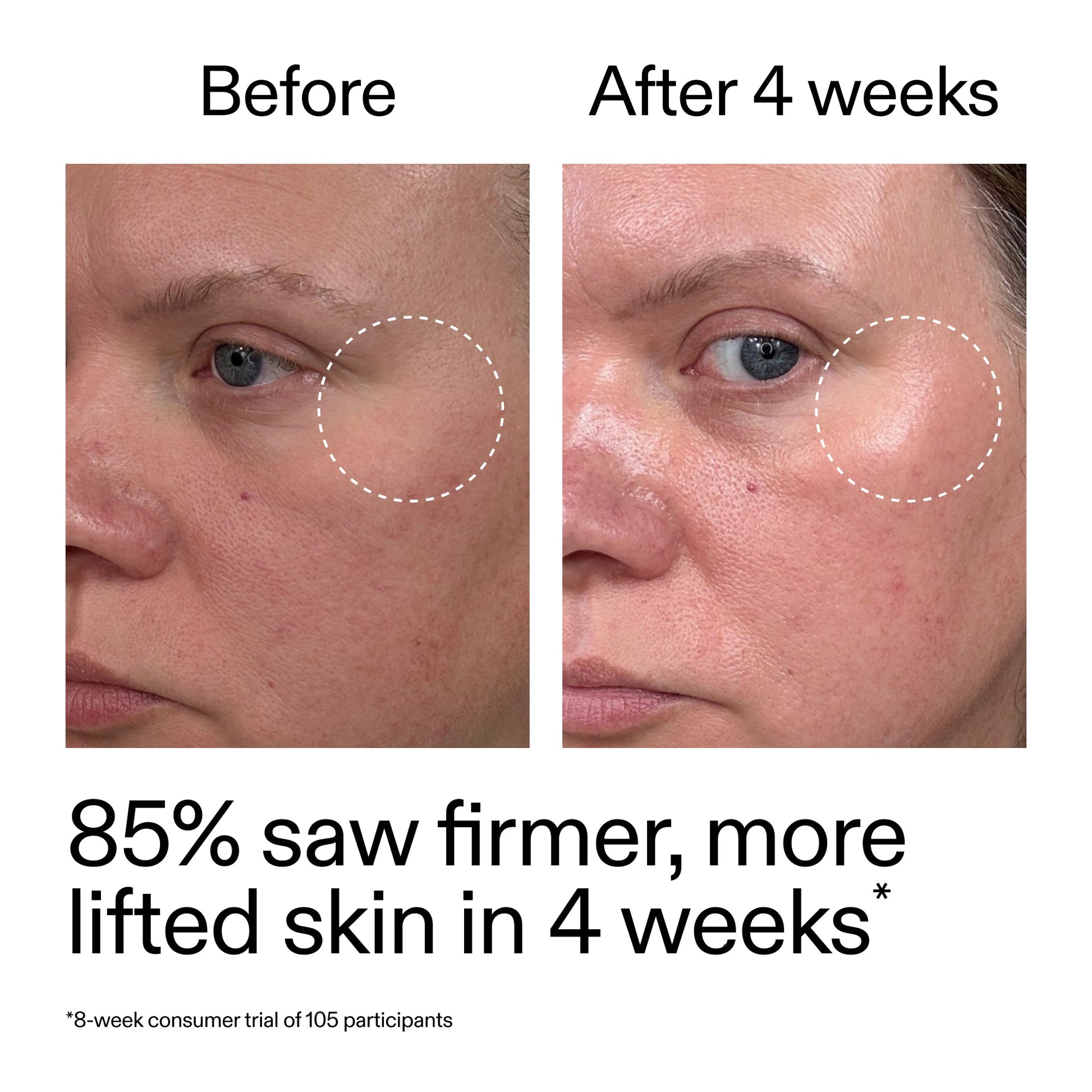 advanced-0-2-retinal-serum-k1 AdvancedRetinal_BeforeAfter_Claim1_2000x2000_bcc385c4-5e73-4f1e-aba8-64267937d0d3.jpg