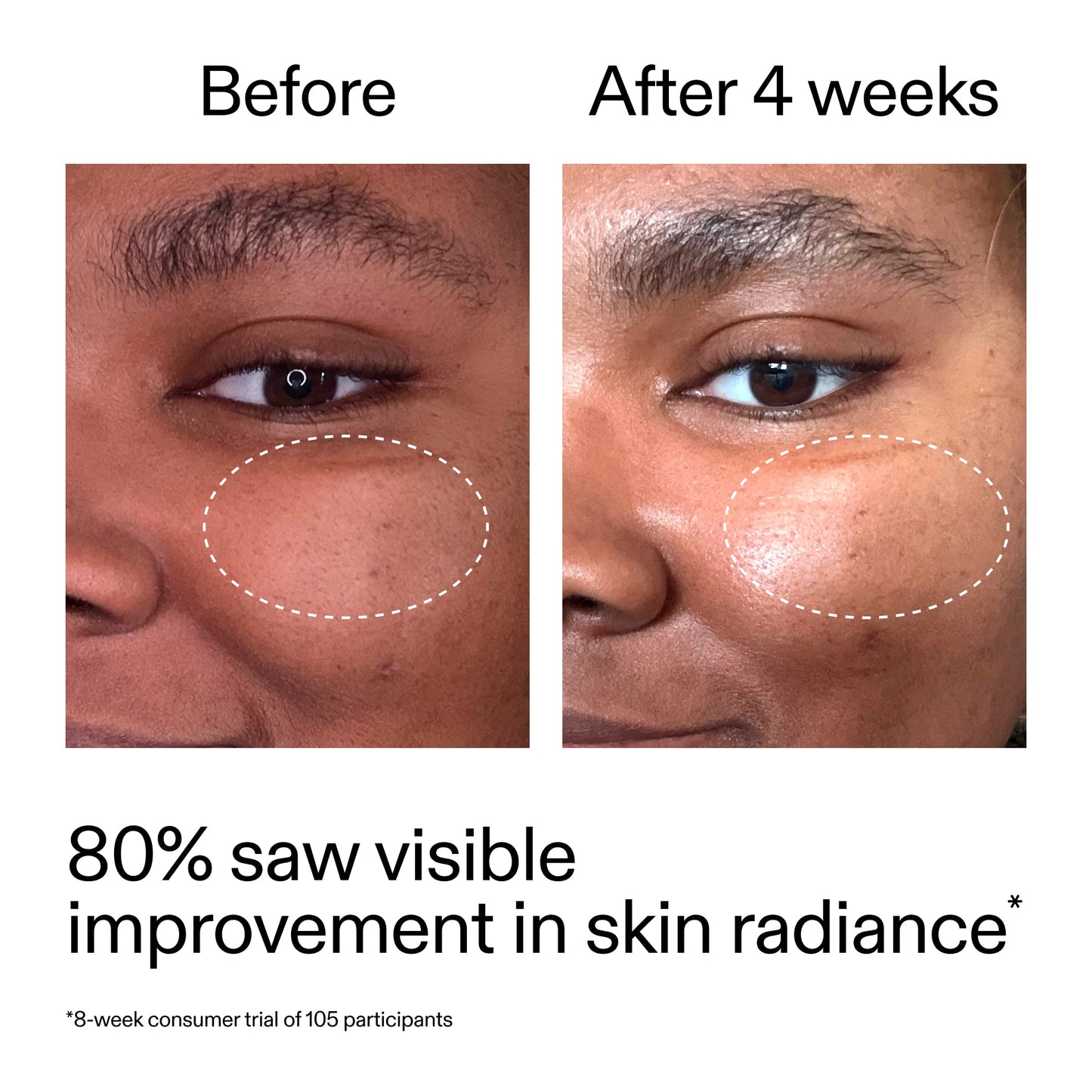 advanced-0-2-retinal-serum-k1 AdvancedRetinal_BeforeAfter_Claim2_2000x2000_39d11e3d-eda9-44ec-ab32-2903b1a368bd.jpg