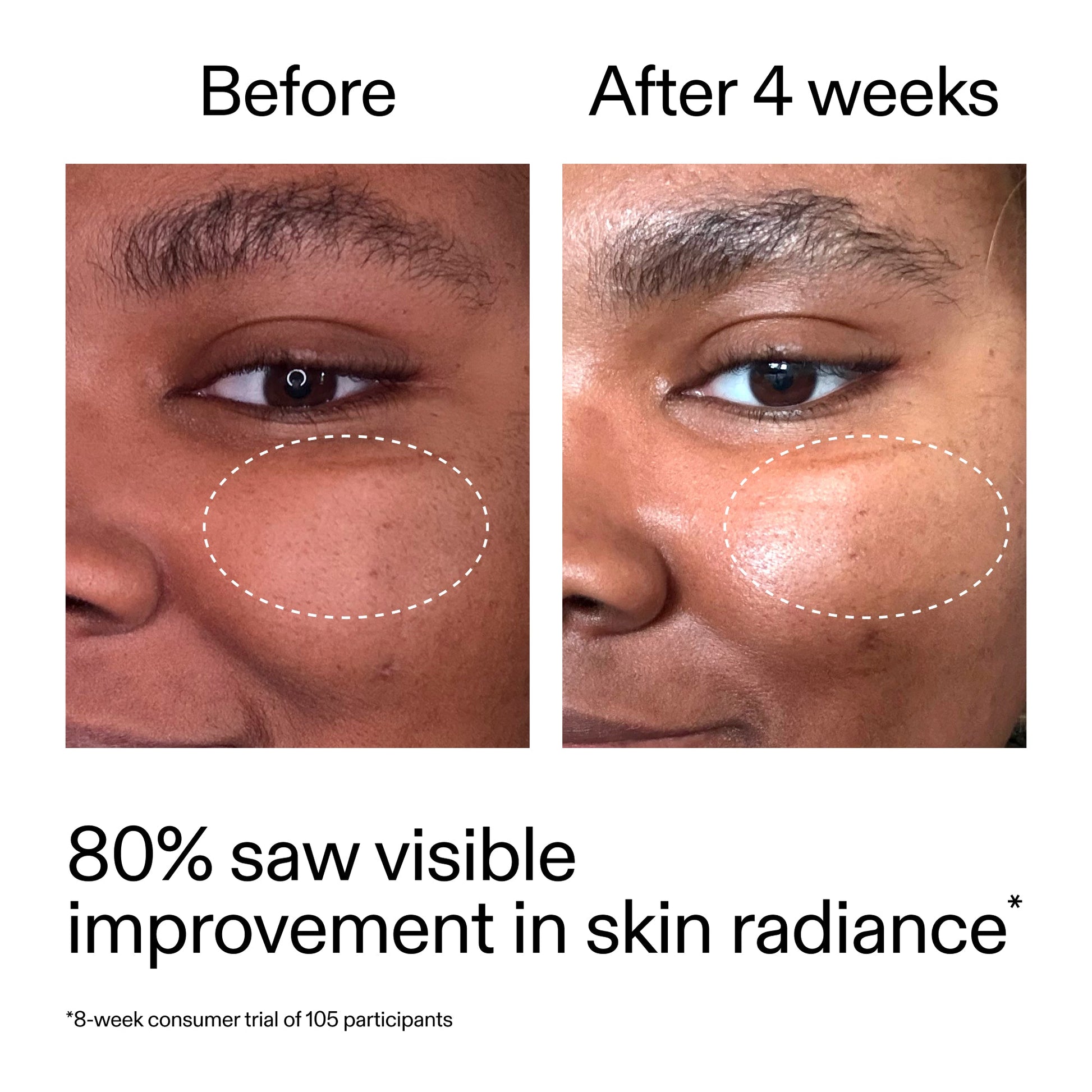 advanced-0-2-retinal-serum-k1 AdvancedRetinal_BeforeAfter_Claim2_2000x2000_39d11e3d-eda9-44ec-ab32-2903b1a368bd.jpg