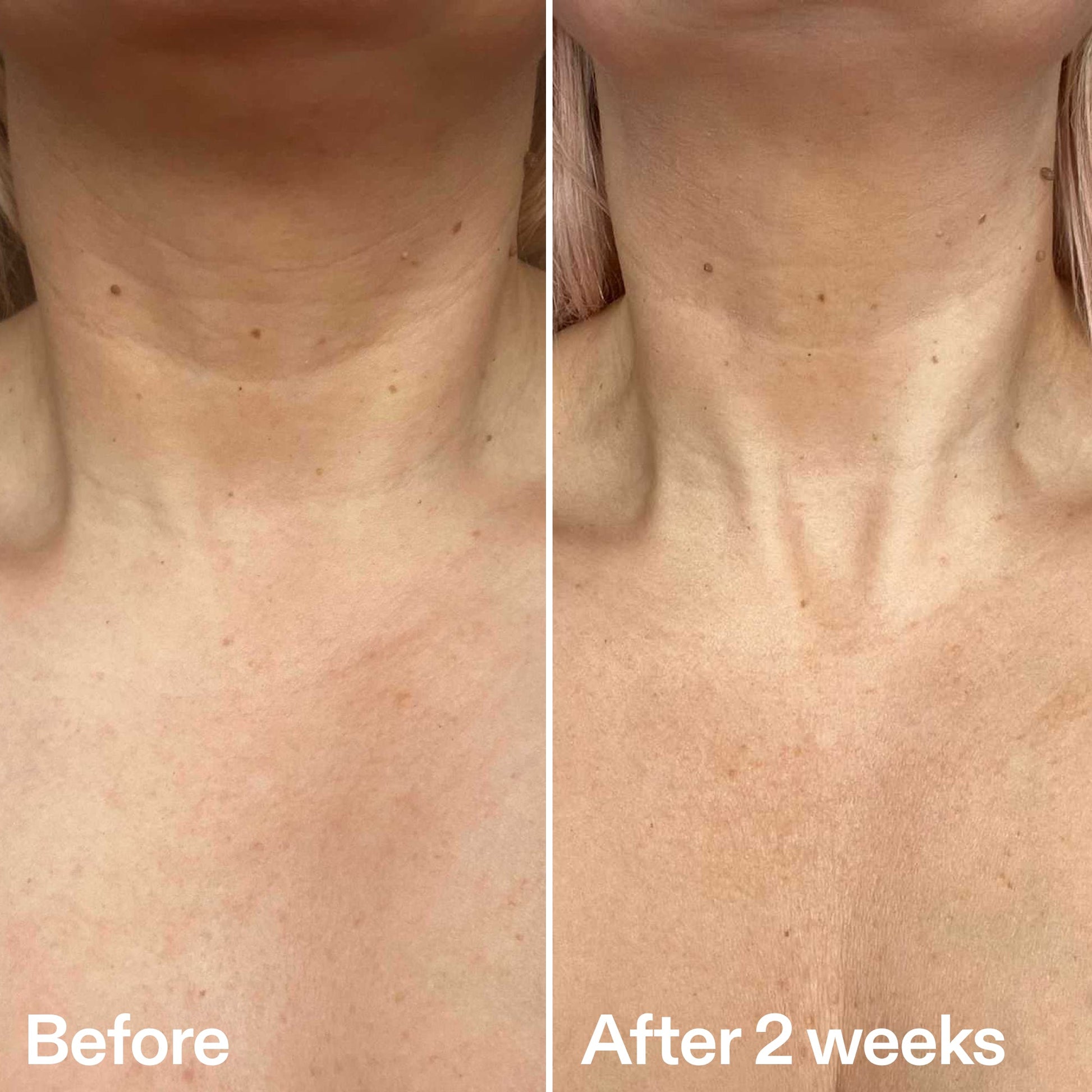 bio-active-neck-lift-stick-z1 B_A_2.jpg