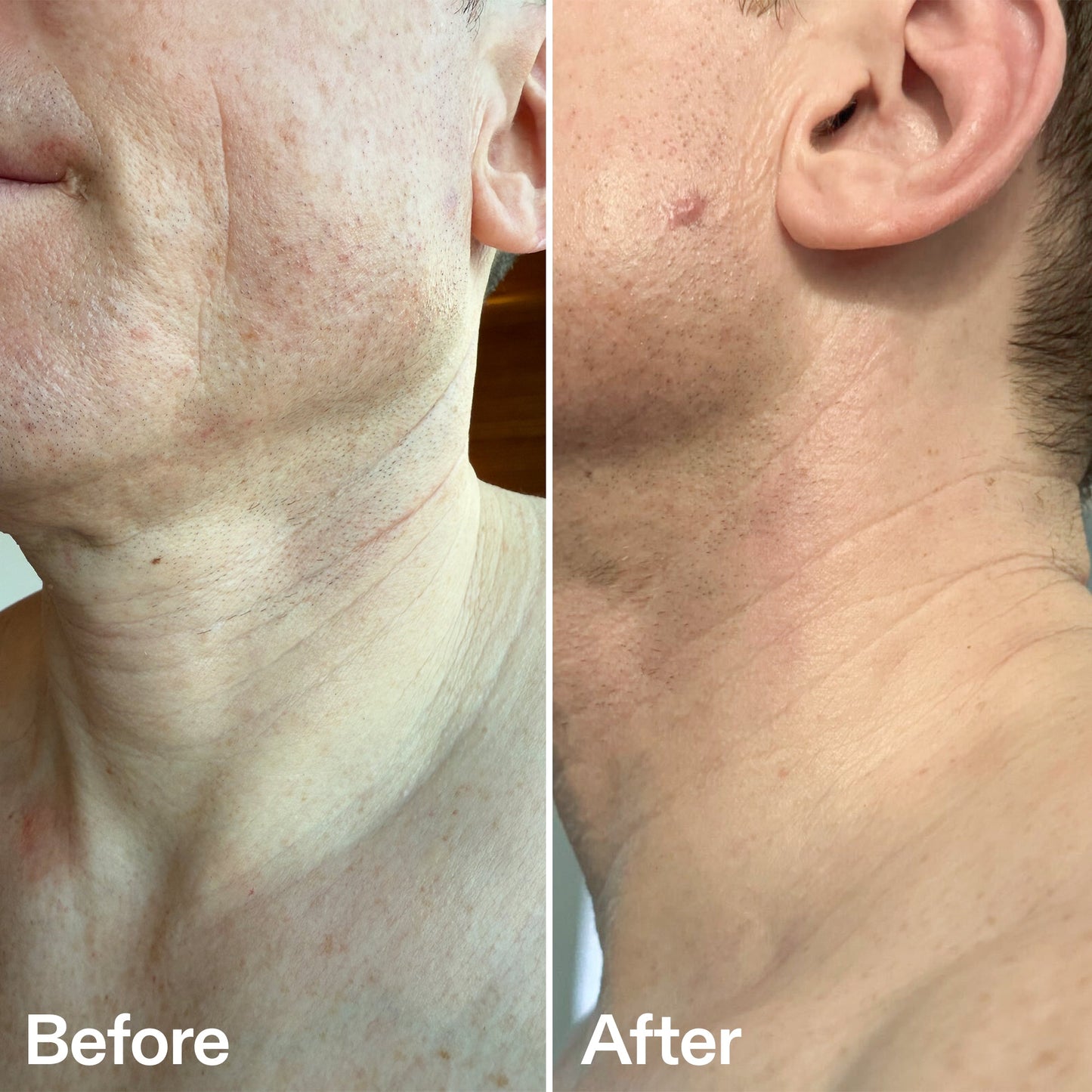 bio-active-neck-lift-stick-z1 B_A_afa2743e-b8e2-4504-92f4-e281cb6cf759.jpg
