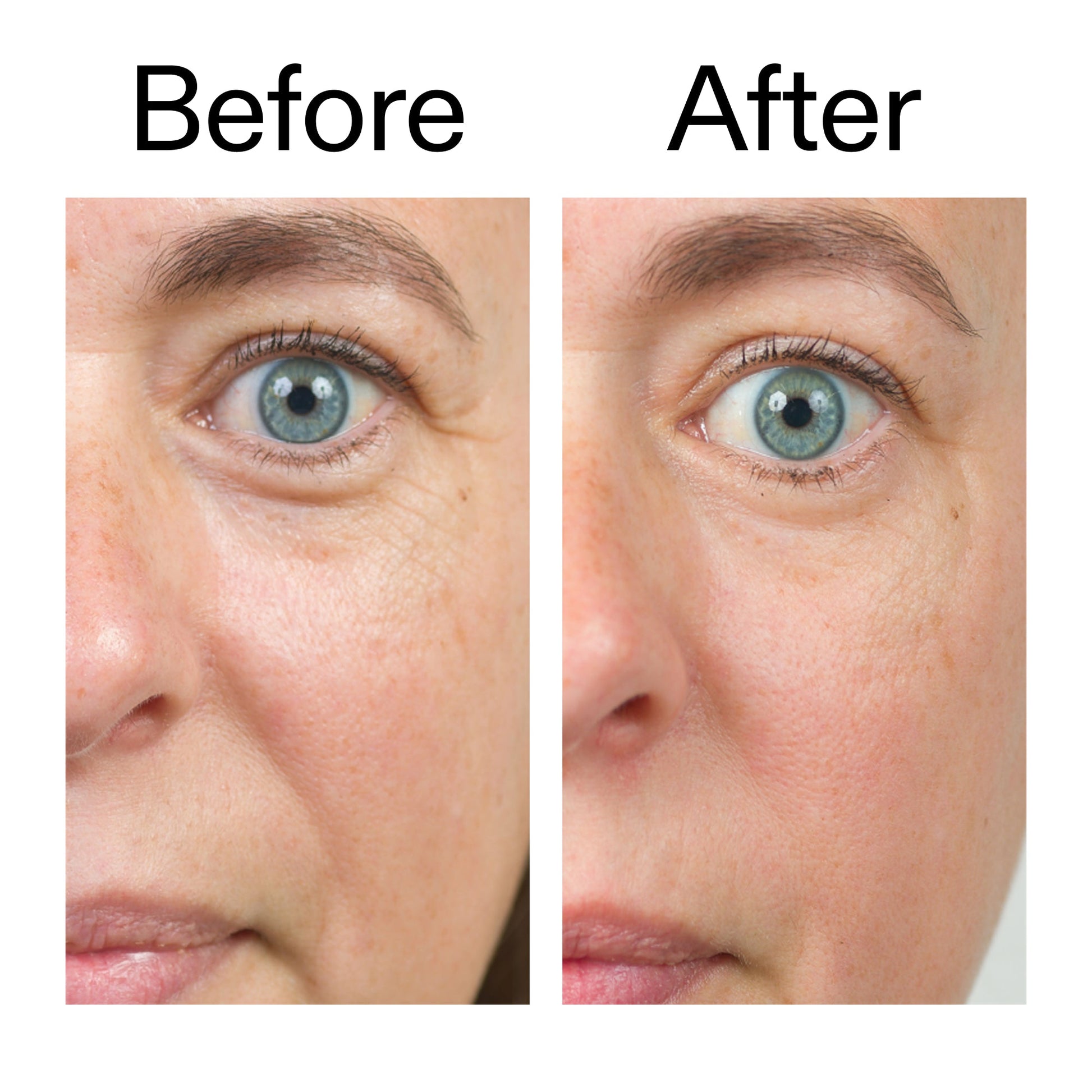 bio-active-ceramide-moisturizer-duo-s2 Bio-Active_Before_After_2000x2000_566e5a9e-135e-417a-8242-b44e5fa35463.jpg