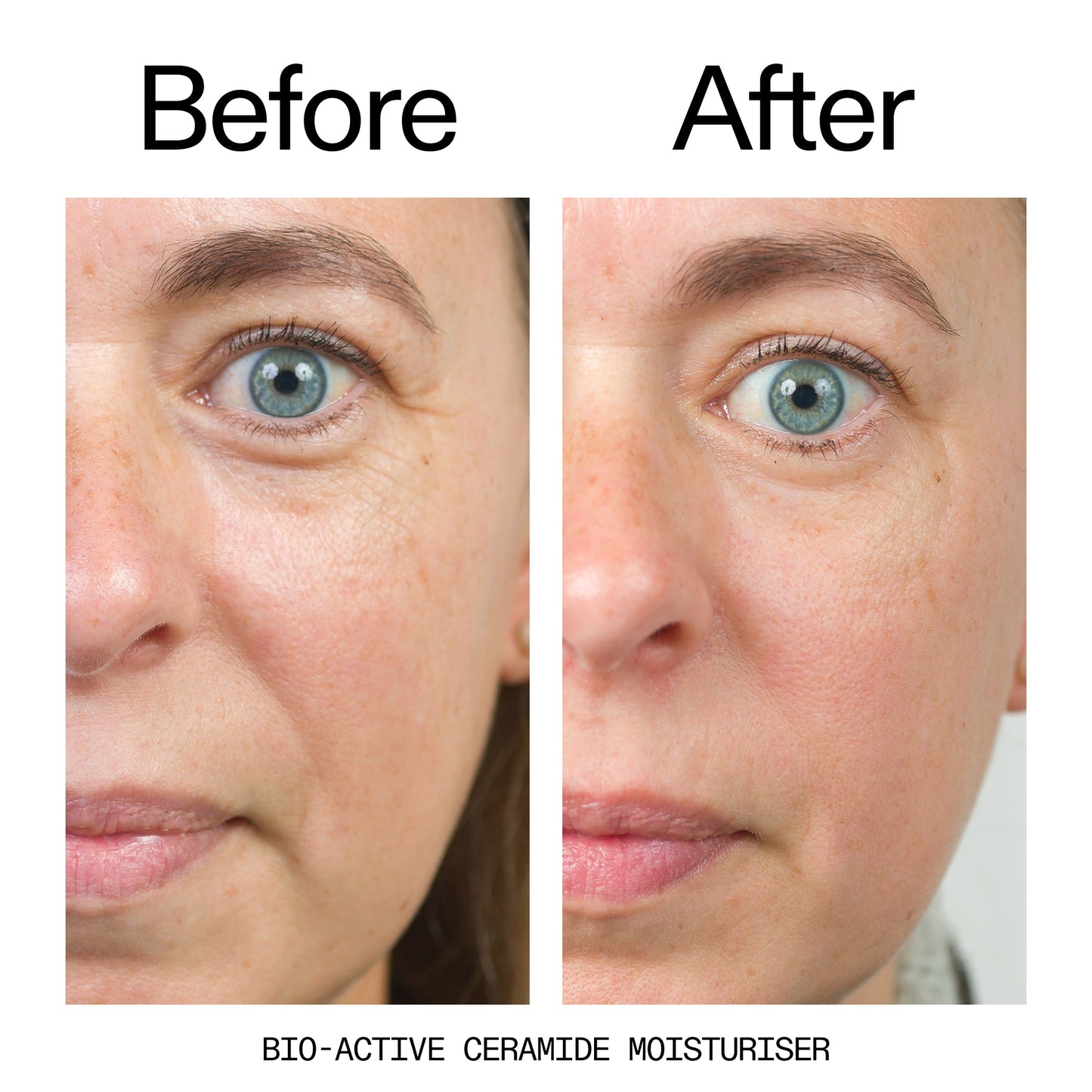 barrier-boosting-trio-b7 Bio-Active_Before_After_2000x2000_600947b4-e8c5-425a-9155-fc15bc83aa12.jpg