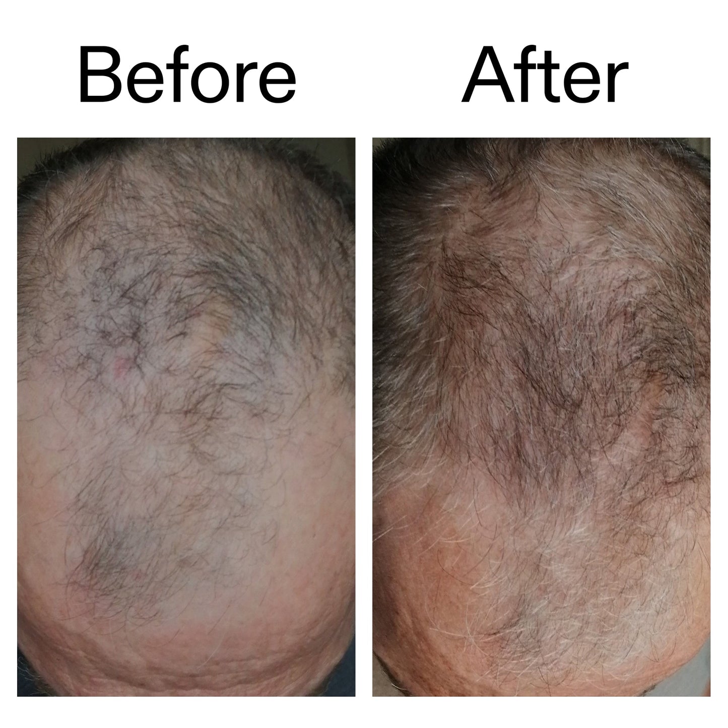 3-month-hair-growth-trio-e7 Caffeine_Scalp_Treatment_B_A_Ppage_2000_x_2000.jpg