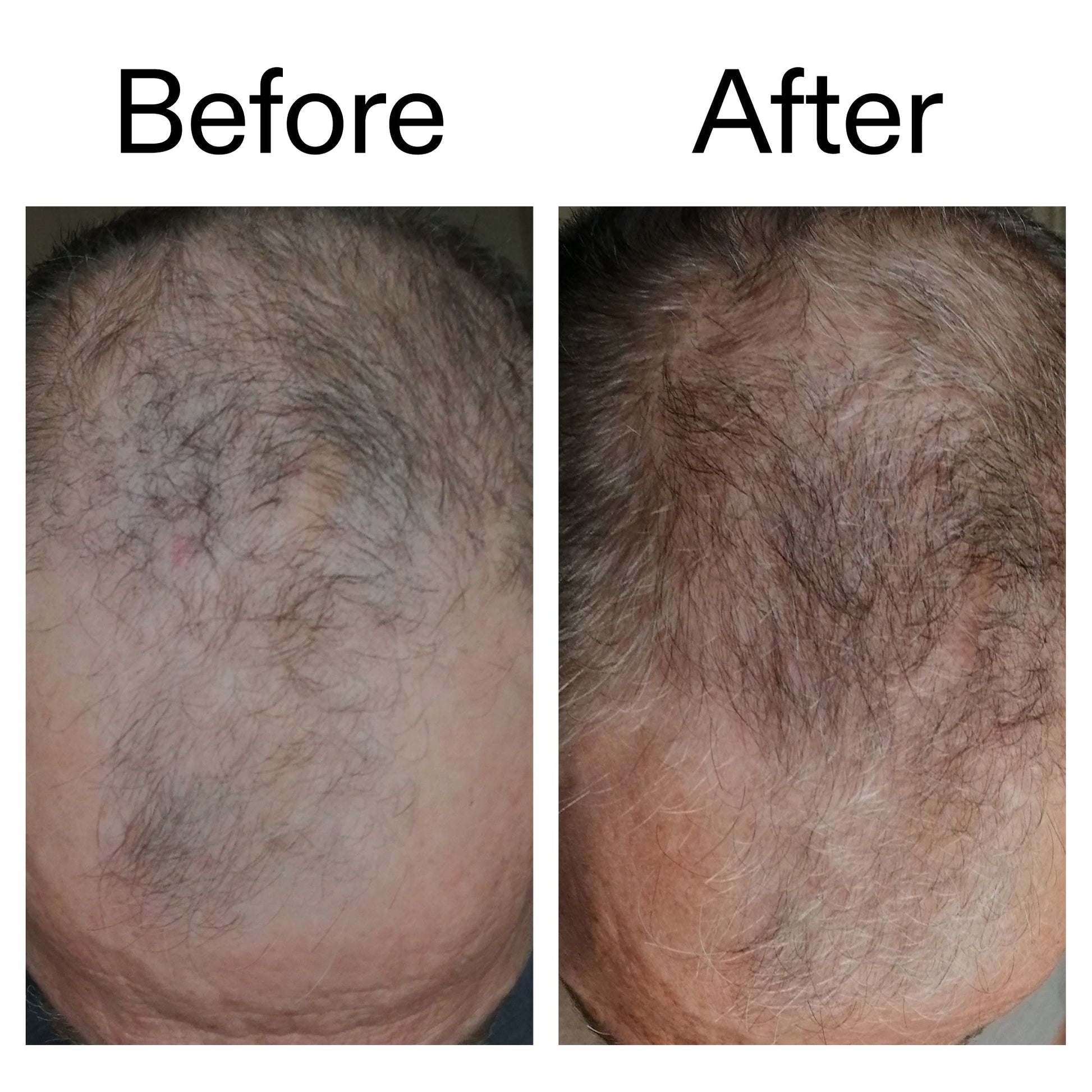 3-month-hair-growth-trio-e7 Caffeine_Scalp_Treatment_B_A_Ppage_2000_x_2000.jpg