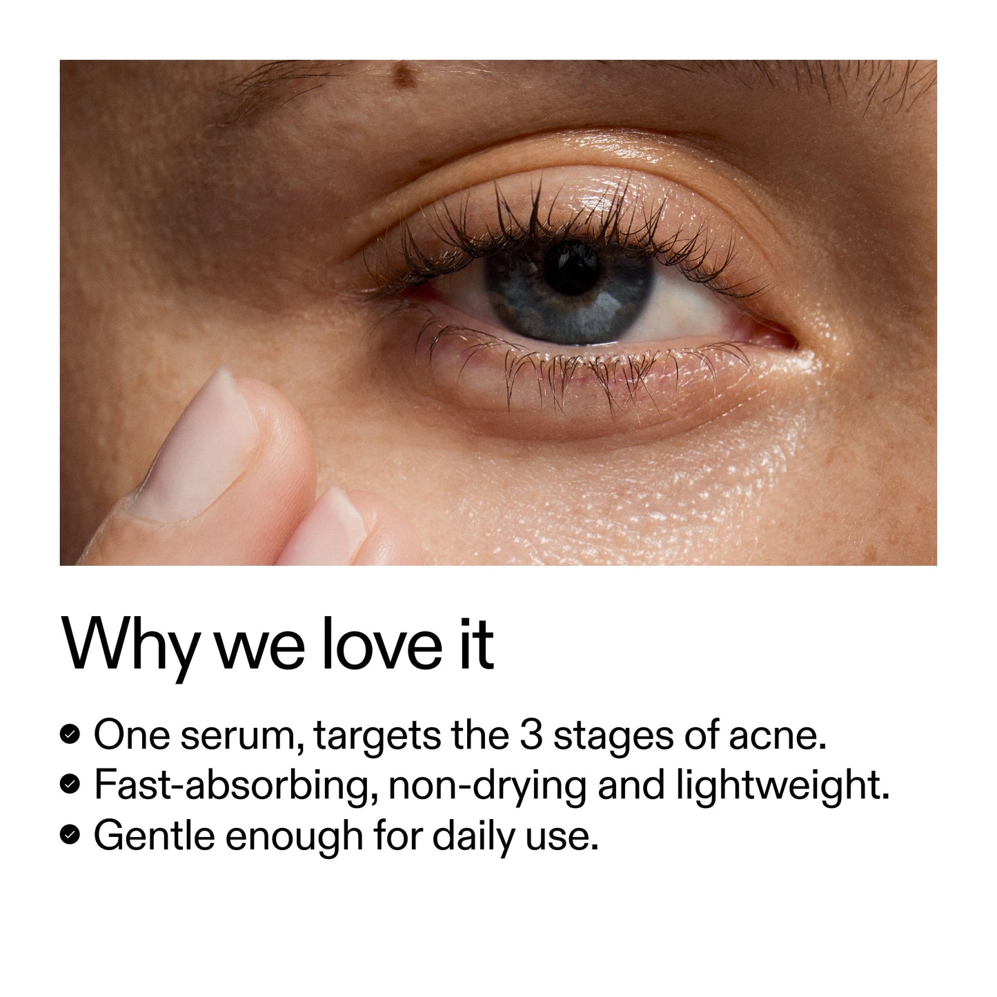 360-acne-clearing-serum-r2 Dioic_Whyweloveit_2000x2000_175aafd3-0cbe-403a-b317-a8362881bfe2.jpg