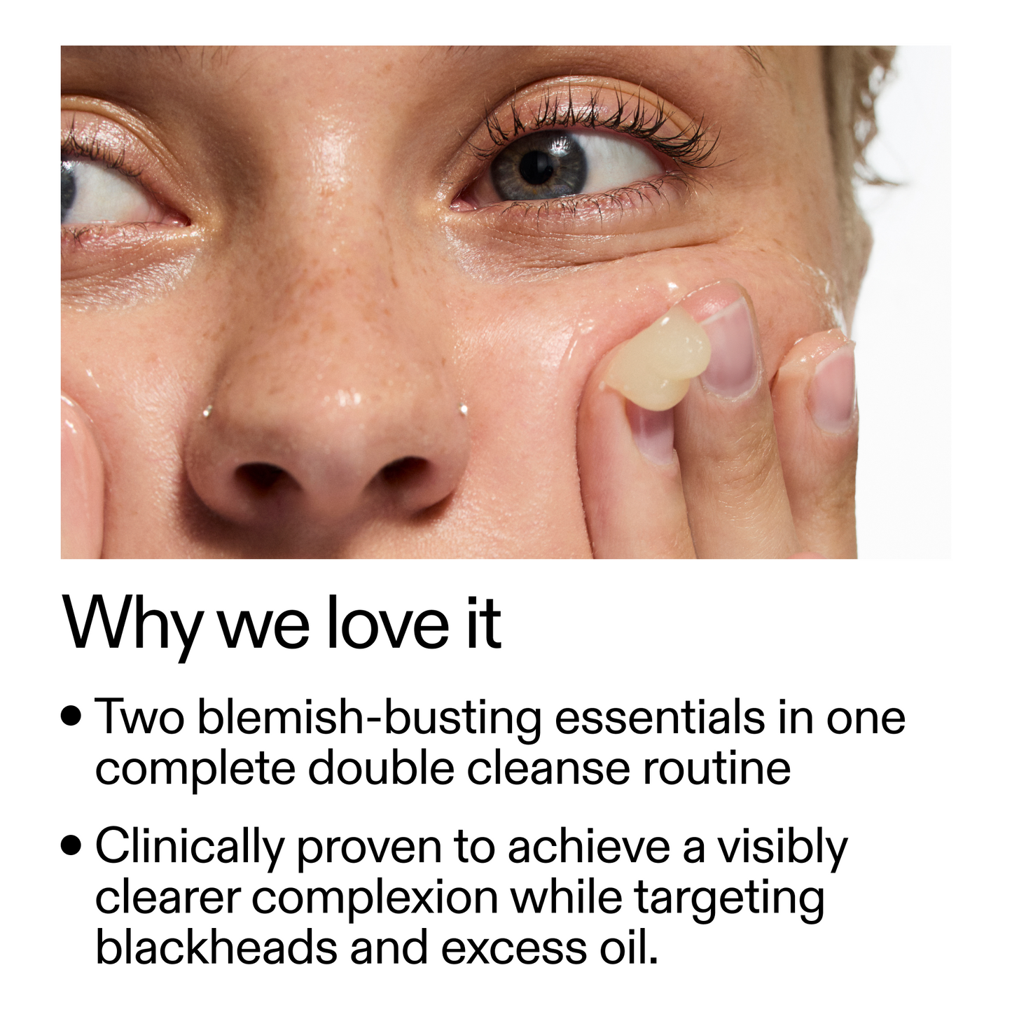 acne-double-cleanse-duo-p9 Double_Cleanse_Duo_for_Breakouts_Why_We_2000x2000_f242cb12-bb5c-487c-b203-071ccb406ec5.png