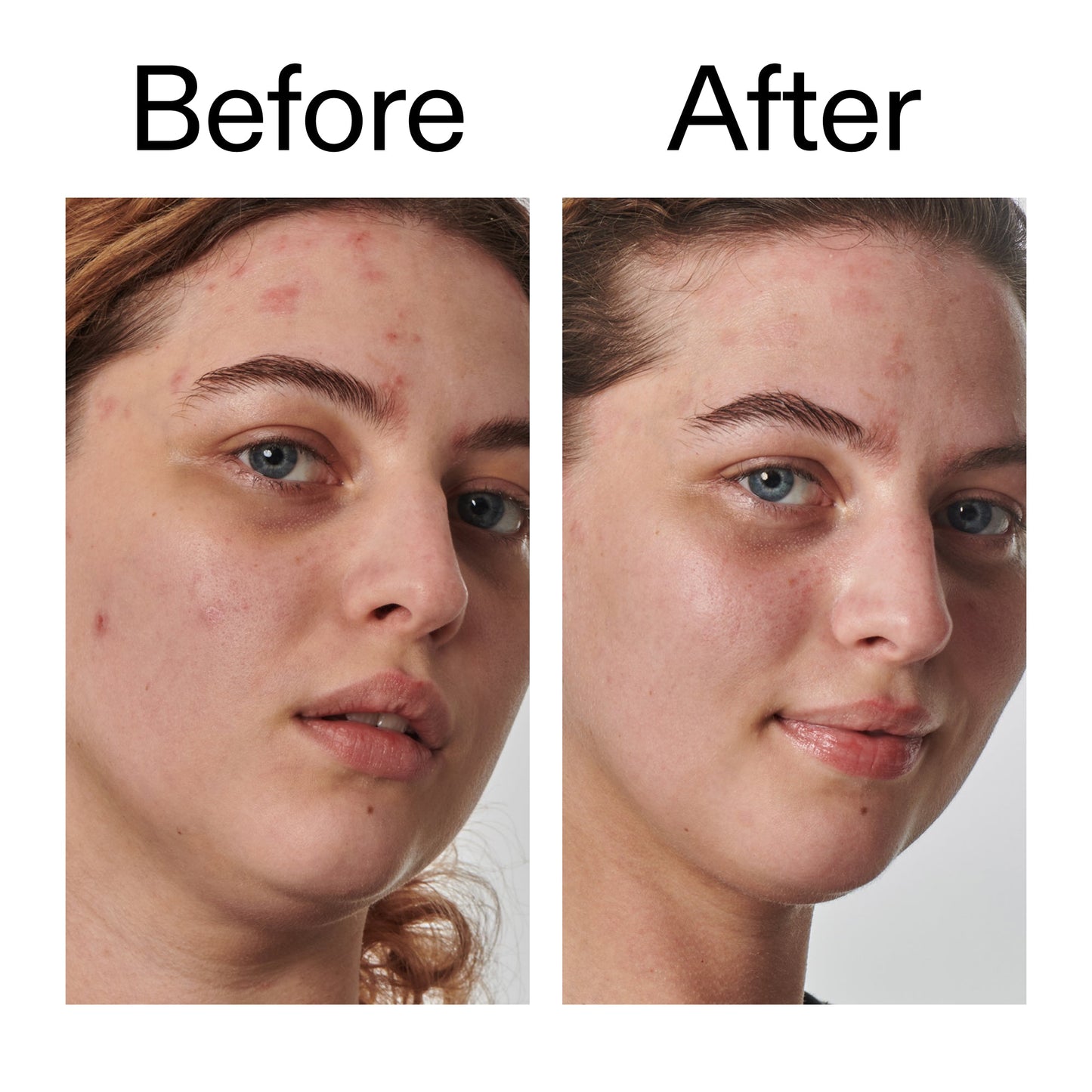 10-urea-moisturizer-g9 Dry_and_Rough_Skin_Solution_Before_After_2000x2000_efa6e639-5c39-49bd-a5dd-f0220293120a.jpg