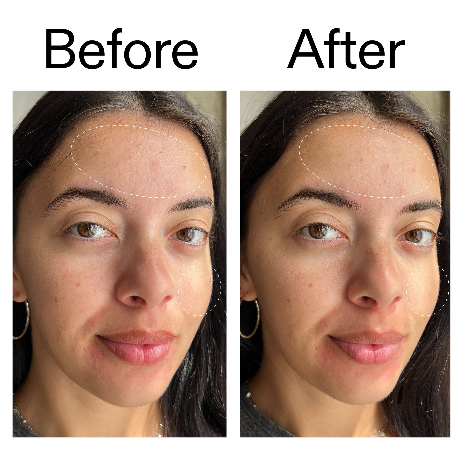 glycerin-gentle-purifying-cleanser-g9 Glycerin_B_A_2000x2000_19037705-c220-4333-99c1-e648cc3ac1d7.jpg