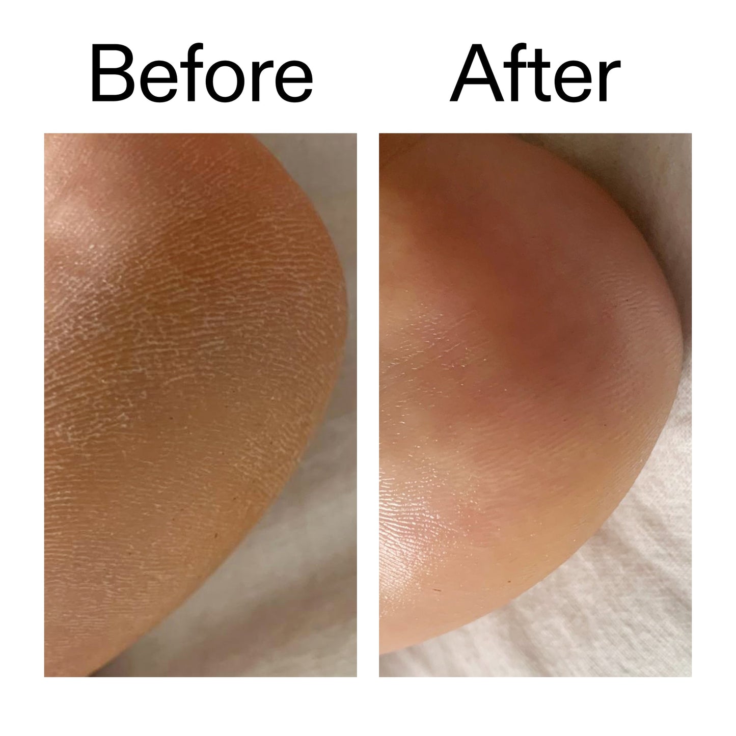 glycolic-acid-exfoliating-body-stick-j8 Glycolic_Acid_Exfoliating_Body_Stick_Before_After_V1_2000x2000_a3043625-9400-429a-a7fb-d6dbd220f722.jpg