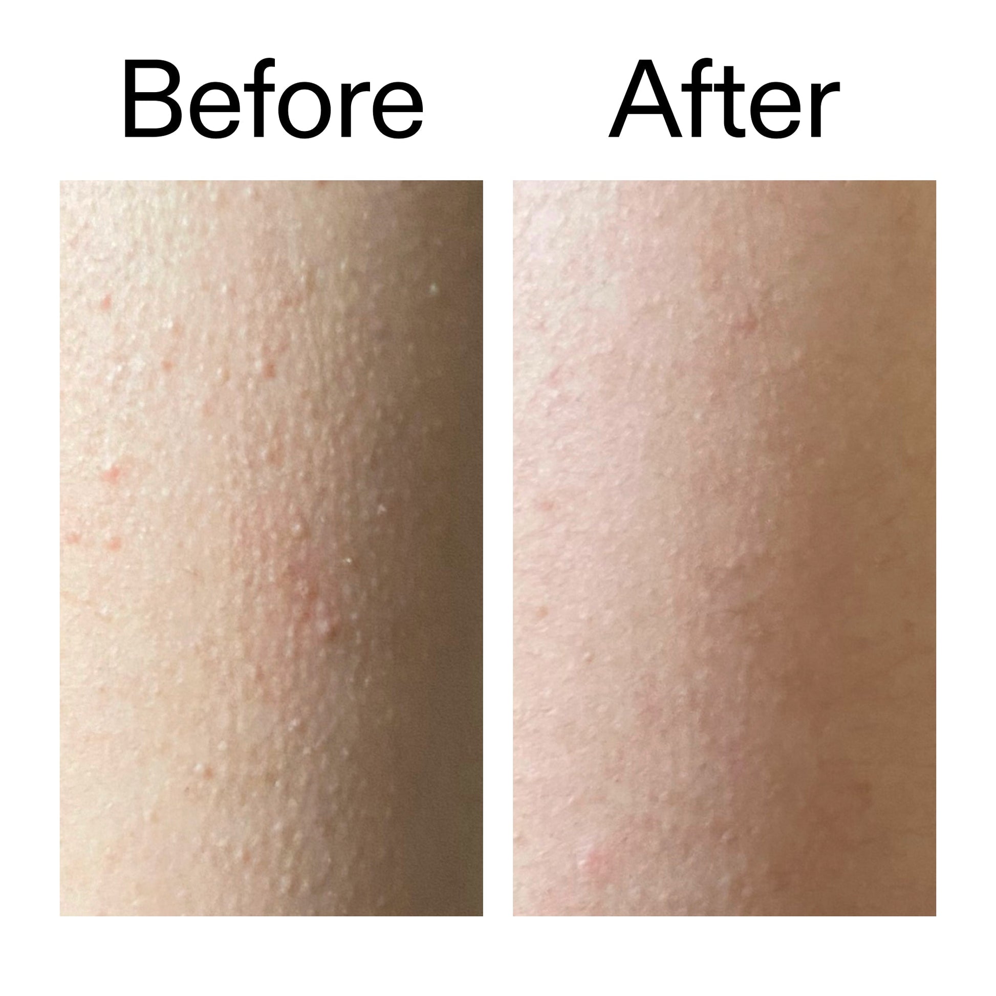 glycolic-acid-exfoliating-body-stick-duo-n8 Glycolic_Acid_Exfoliating_Body_Stick_Before_After_V2_2000x2000_2e4ba052-94f6-4d56-82df-7bdb5b2df7ae.jpg