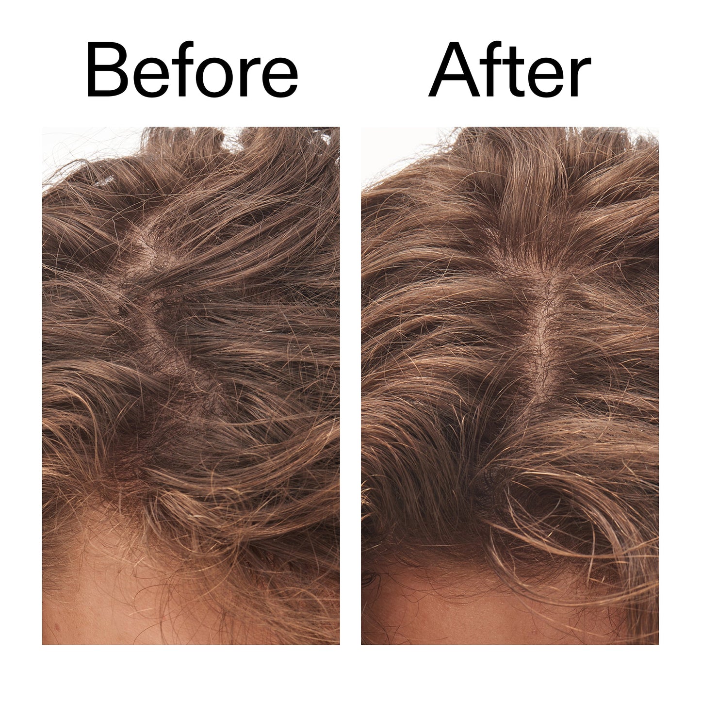 glycolic-acid-exfoliating-scalp-scrub-f9 Glycolic_Acid_Exfoliating_Scalp_Scrub_Before_After_2000x2000_b8561c87-05a1-4caa-80f7-1b6b33d750f7.jpg