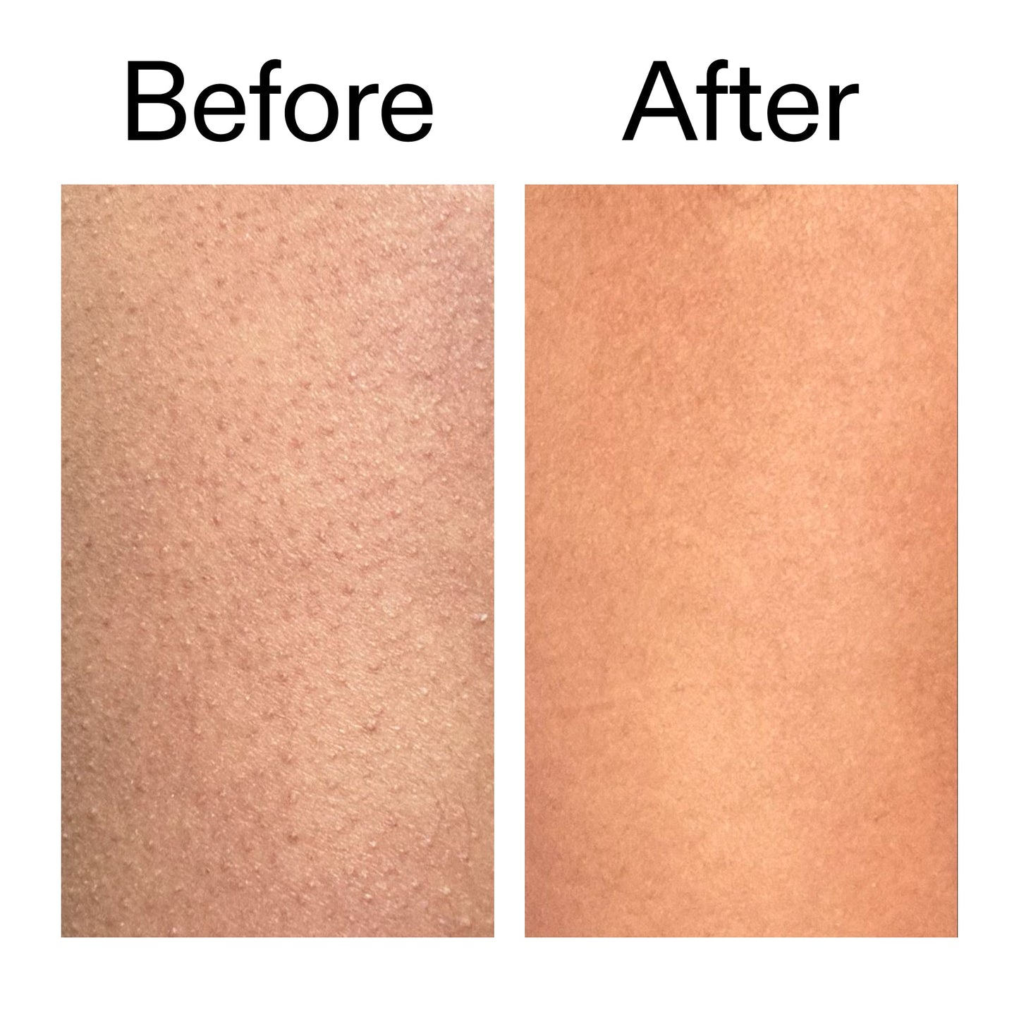 glycolic-acid-exfoliating-body-stick-duo-n8 Glycolic_Body_Stick_B_A_2000x2000_6e6e6b4d-5bd7-43c0-aeed-4d66788e8995.jpg
