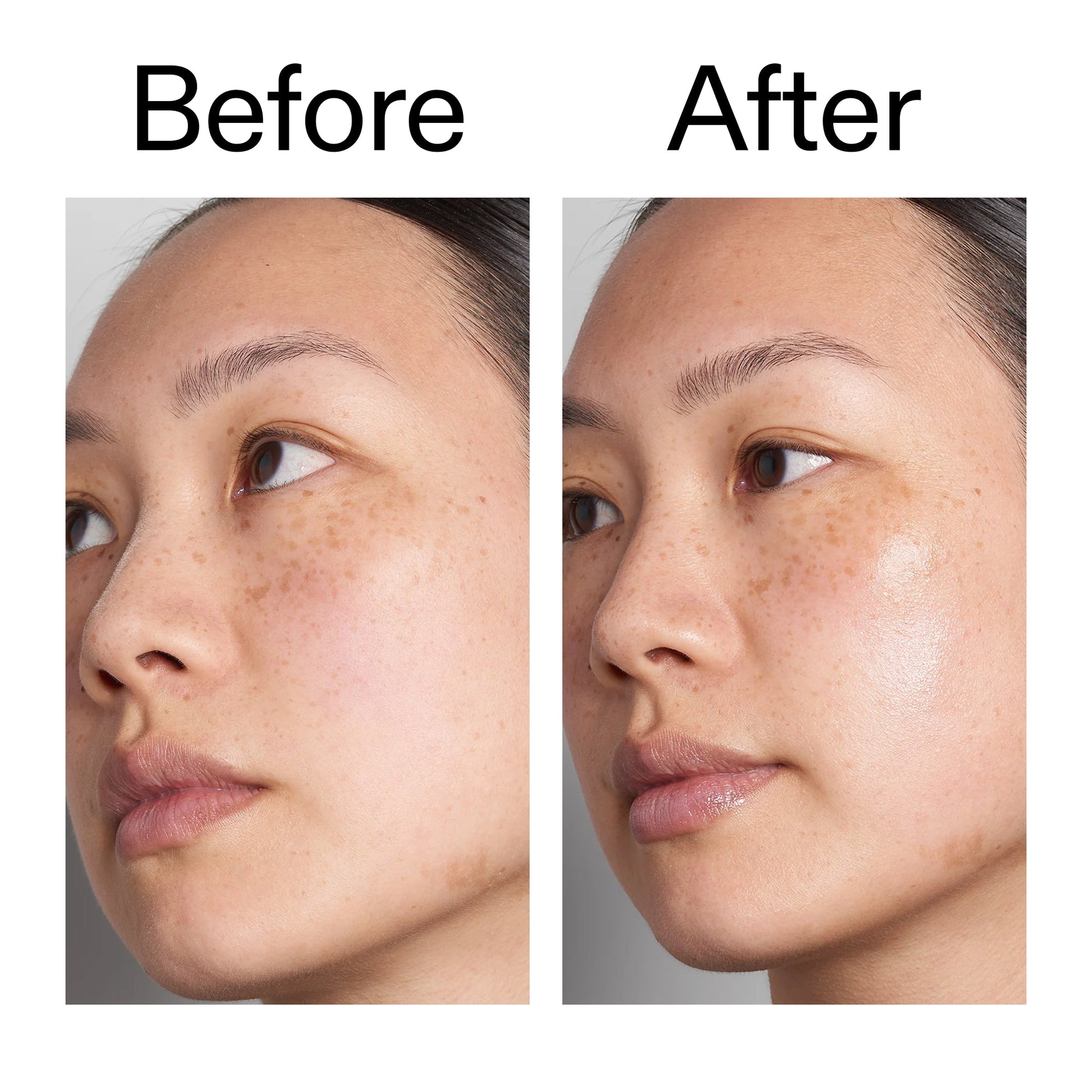 hyaluronic-acid-serum-60ml-q7 Hyaluronic_Acid_Before_After_2000x2000_d7983956-8aa2-4ea3-8255-c63e8d4f892e.jpg