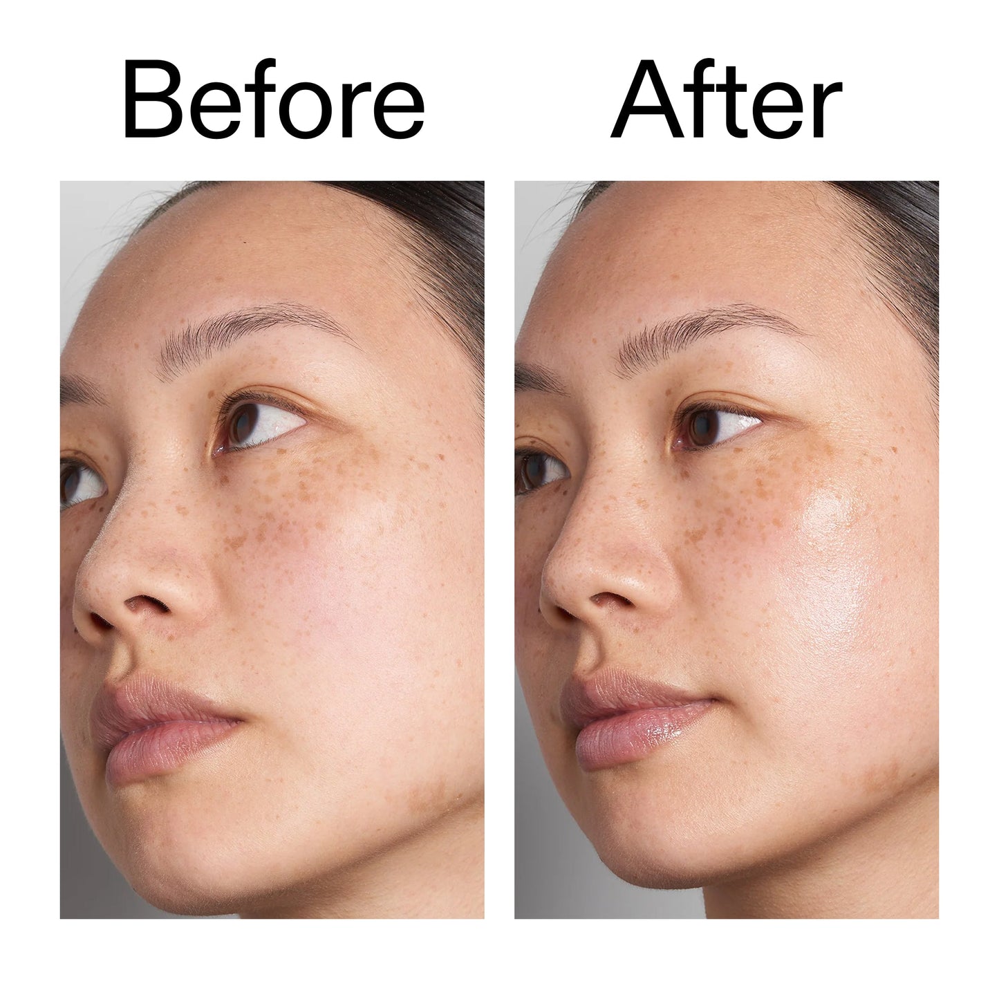 hyaluronic-acid-serum-30ml-i1 Hyaluronic_Acid_Before_After_2000x2000_d7983956-8aa2-4ea3-8255-c63e8d4f892e.jpg