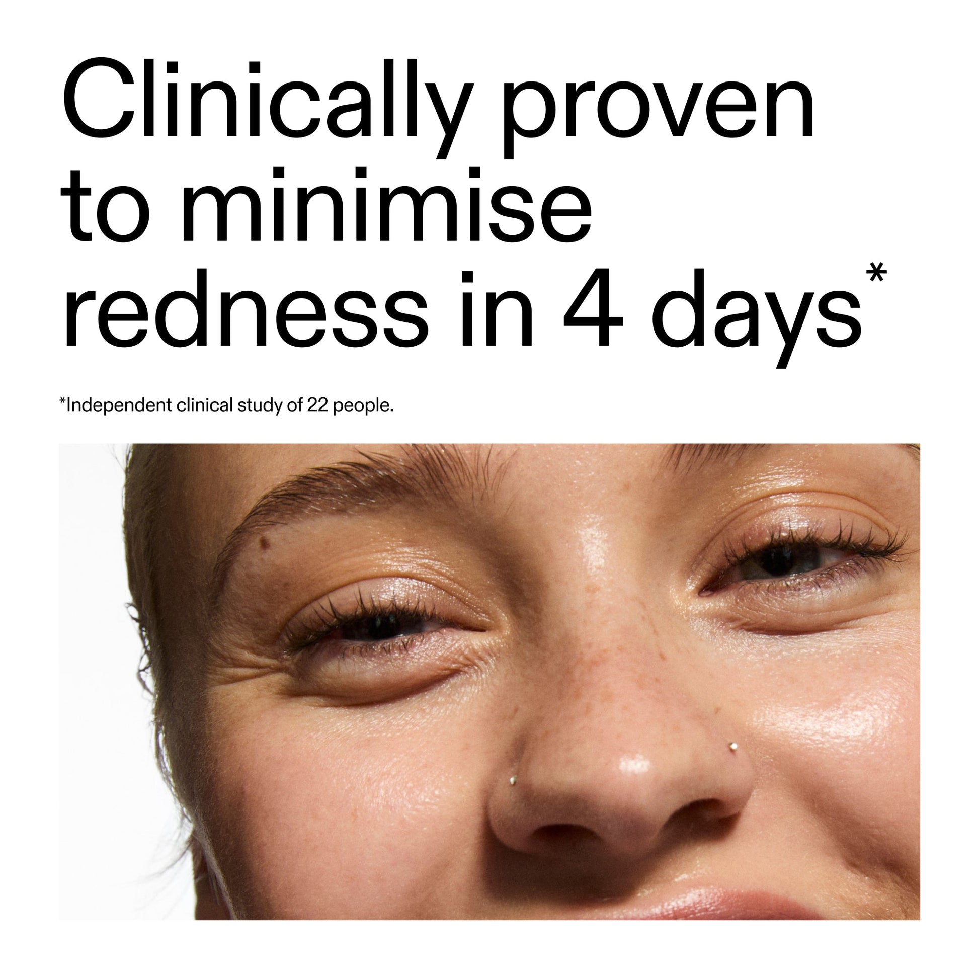 10-azelaic-acid-serum-for-redness-relief-x0 Oat_Cleansing_Balm_Claim_2000x2000_52a841dc-353c-4f2c-8646-3aadb604507d.jpg