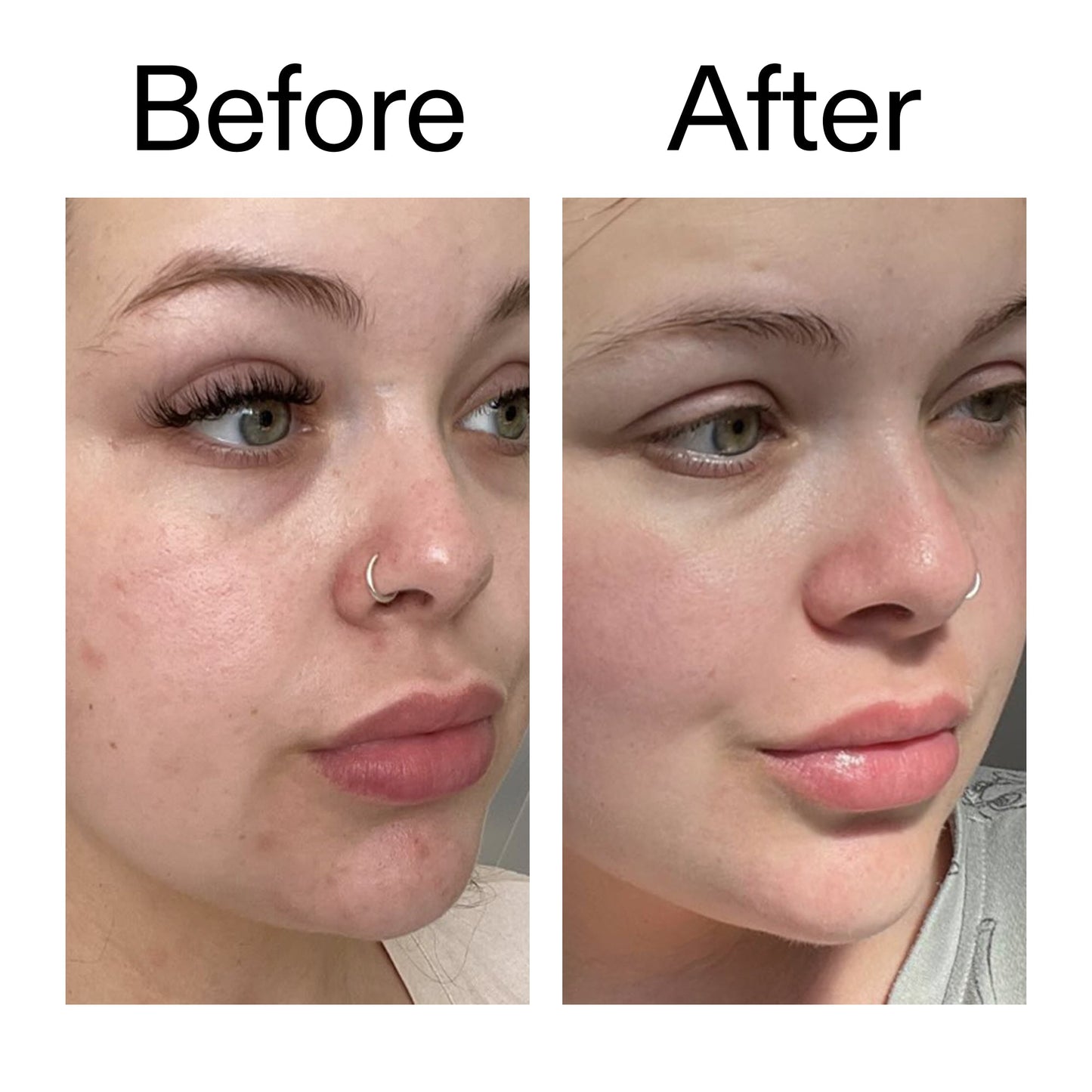 omega-water-cream-50ml-q2 Omega50_Before_After_2000x2000_46483ed8-3f9d-487f-9a0c-9df79830bd65.jpg