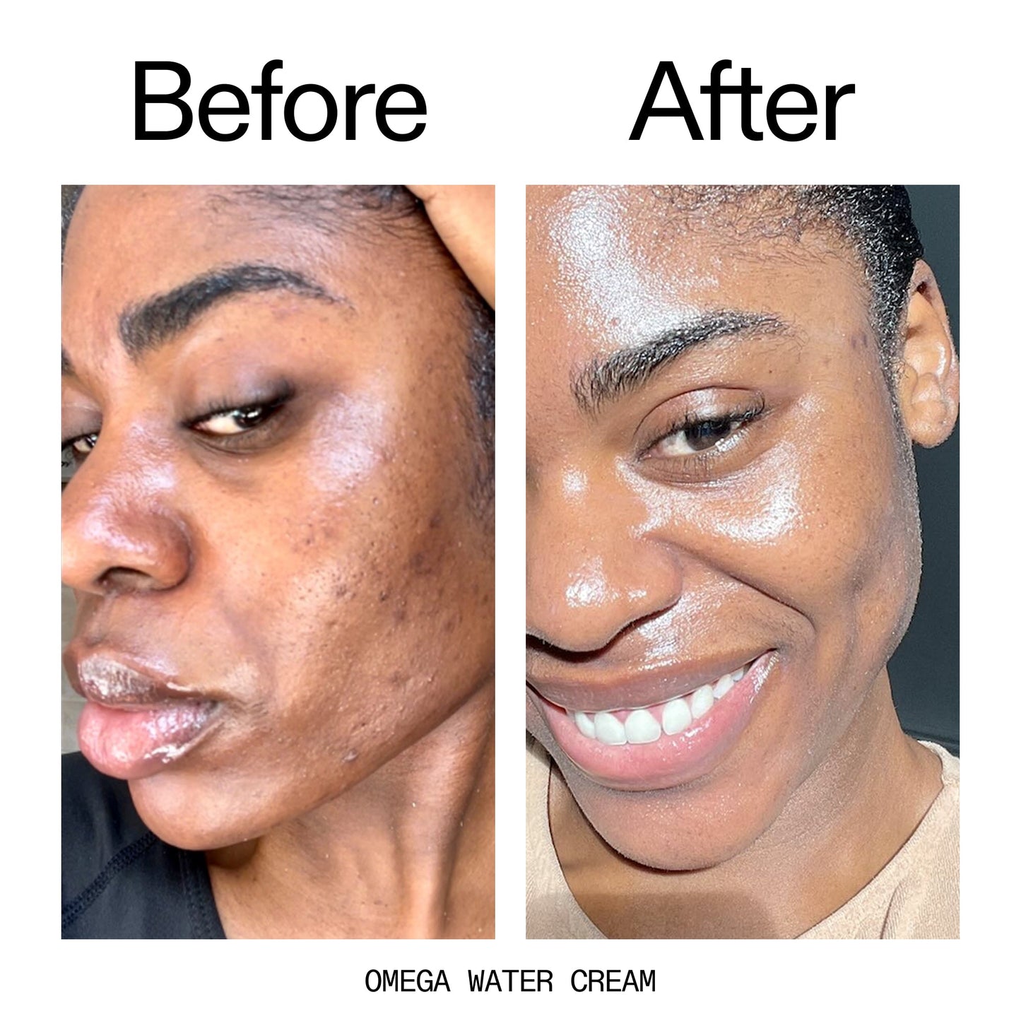glowing-skin-set-d0 Omega_Water_Cream_Before_After_2000x2000_8e88278b-8c8d-48dc-ac77-4e98ebbd1b77.jpg