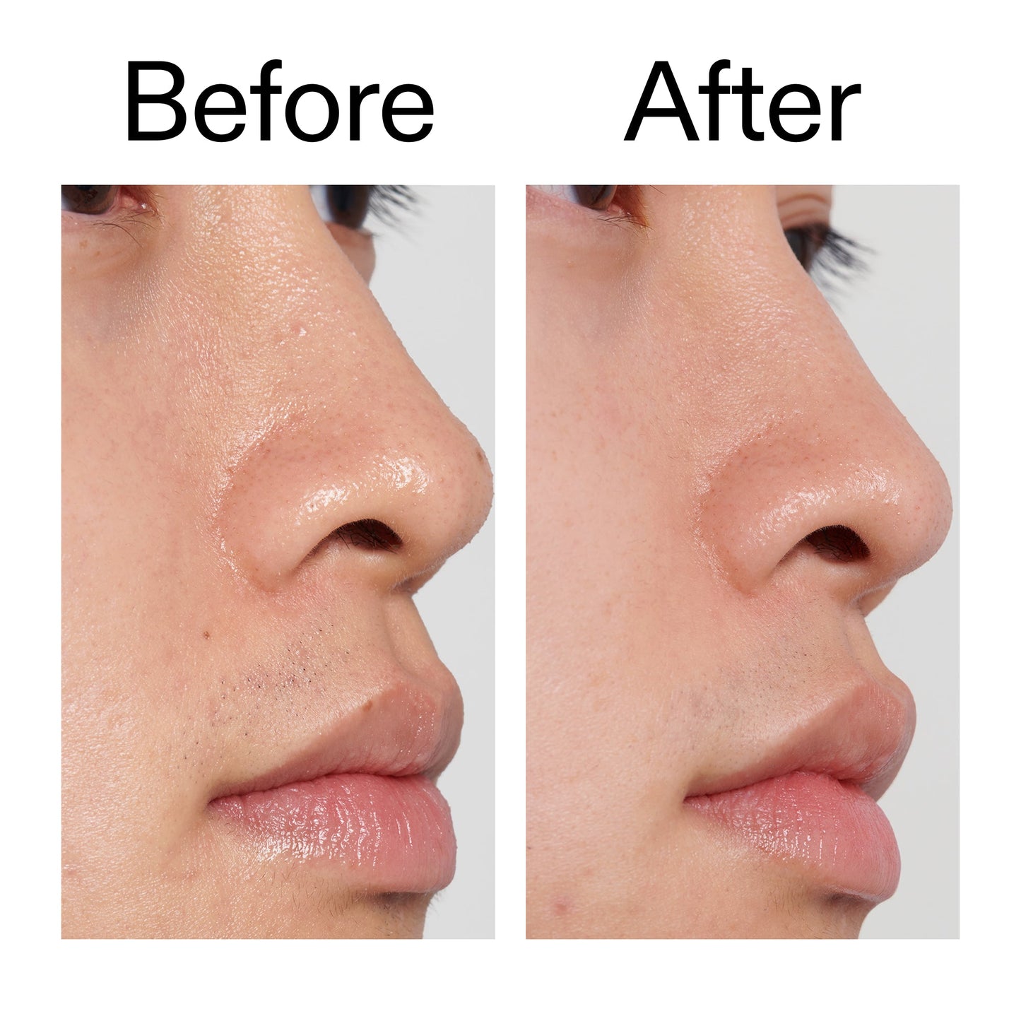 pha-toner-v8 PHA_Toner_Before_After_2000x2000_e3c10172-0150-4342-8b95-57417eaff50d.jpg
