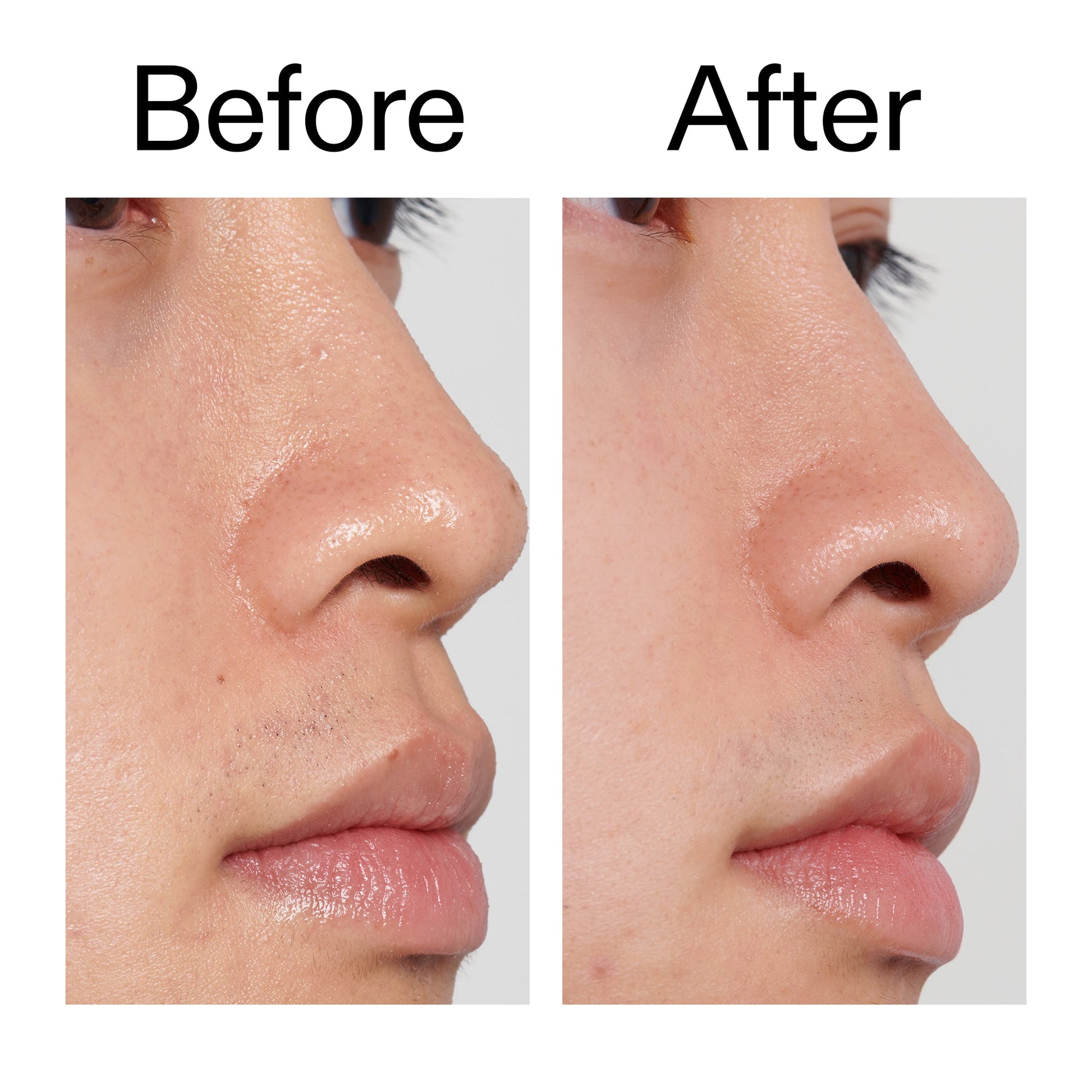 pha-toner-v8 PHA_Toner_Before_After_2000x2000_e3c10172-0150-4342-8b95-57417eaff50d.jpg