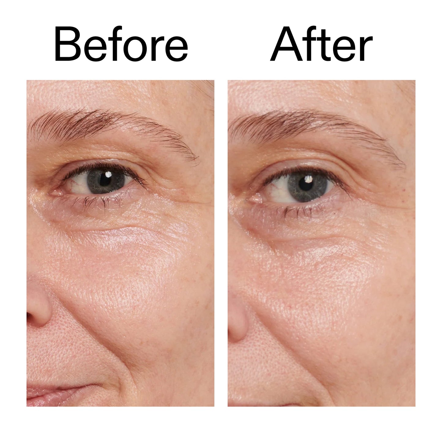 retinol-eye-cream-s4 Retinol_Eye_Cream_Before_After_2000x2000_ac03a80c-109e-4572-a95a-91dc109b4d27.jpg