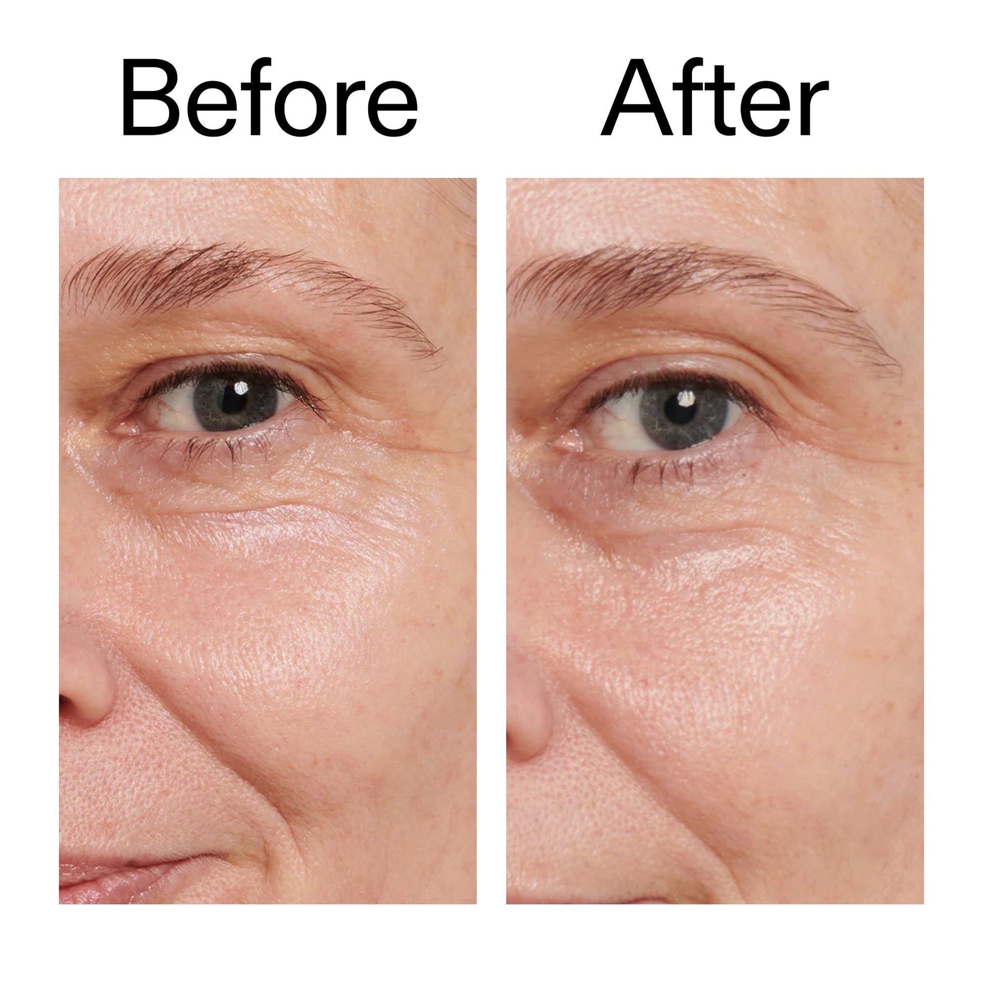 retinol-eye-cream-s4 Retinol_Eye_Cream_Before_After_2000x2000_ac03a80c-109e-4572-a95a-91dc109b4d27.jpg