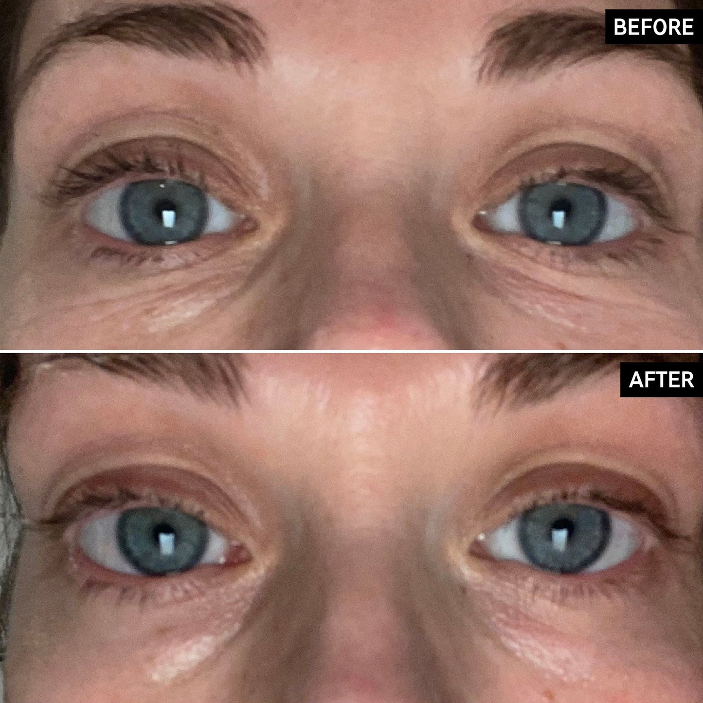 retinol-eye-cream-s4 SITE-UGCBAsApril_Nicole_B_A_PPage_2000x2000_1.jpg