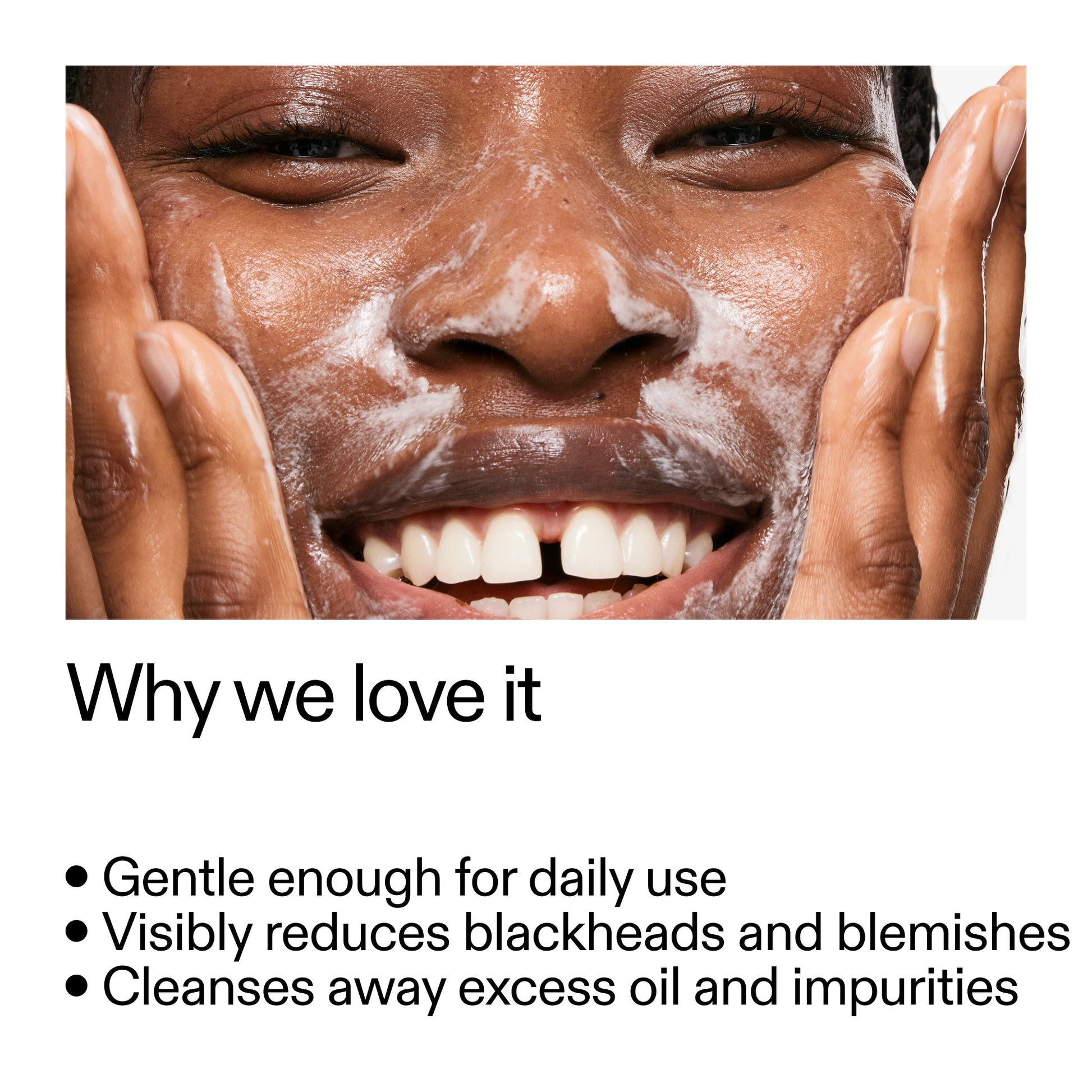 salicylic-acid-cleanser-150ml-d5 Salicylic_Acid_Cleanser_-_300mlWhy_we_love_it_2000x2000_87dc92a9-2559-4309-98cd-4e570f1be735.jpg