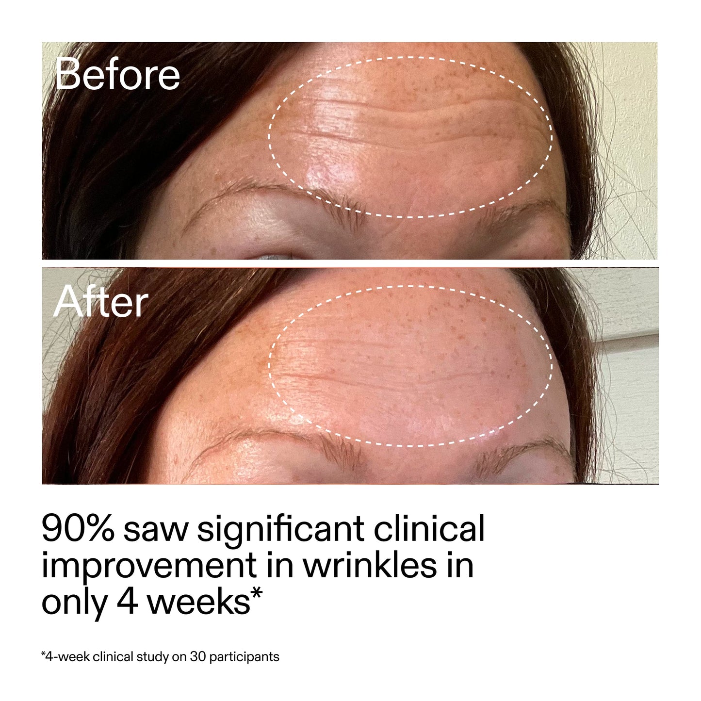 starter-retinol-serum-duo-z6 StarterRetinol_BeforeAfter_Claim1_2000x2000_03b4d6e5-a357-43b9-a855-aba5e35c57f3.jpg