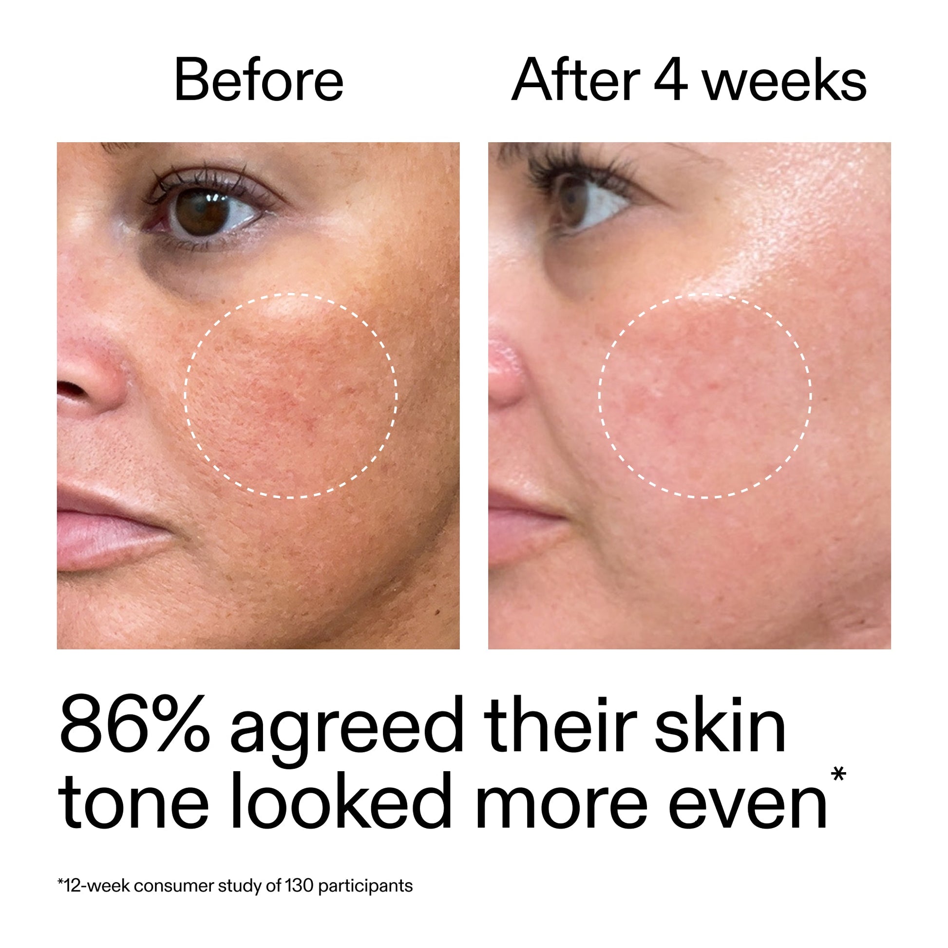 starter-retinol-serum-duo-l8 StarterRetinol_BeforeAfter_Claim2_2000x2000_fc5bb8ac-8588-478f-98d5-28af6651601a.jpg