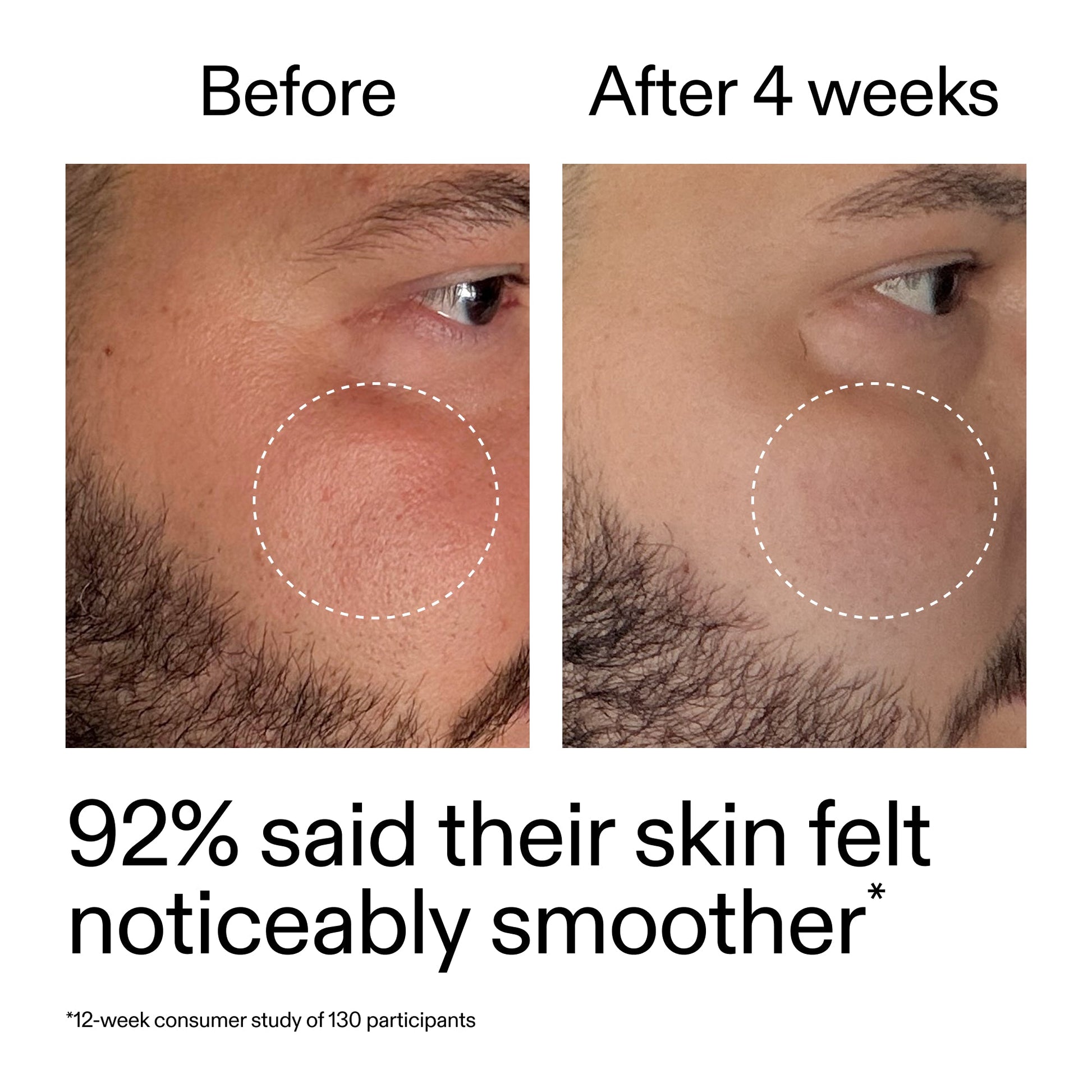 starter-retinol-serum-g0 StarterRetinol_BeforeAfter_Claim3_2000x2000_6ceab106-e0ee-4ed4-ba62-41bc39538038.jpg