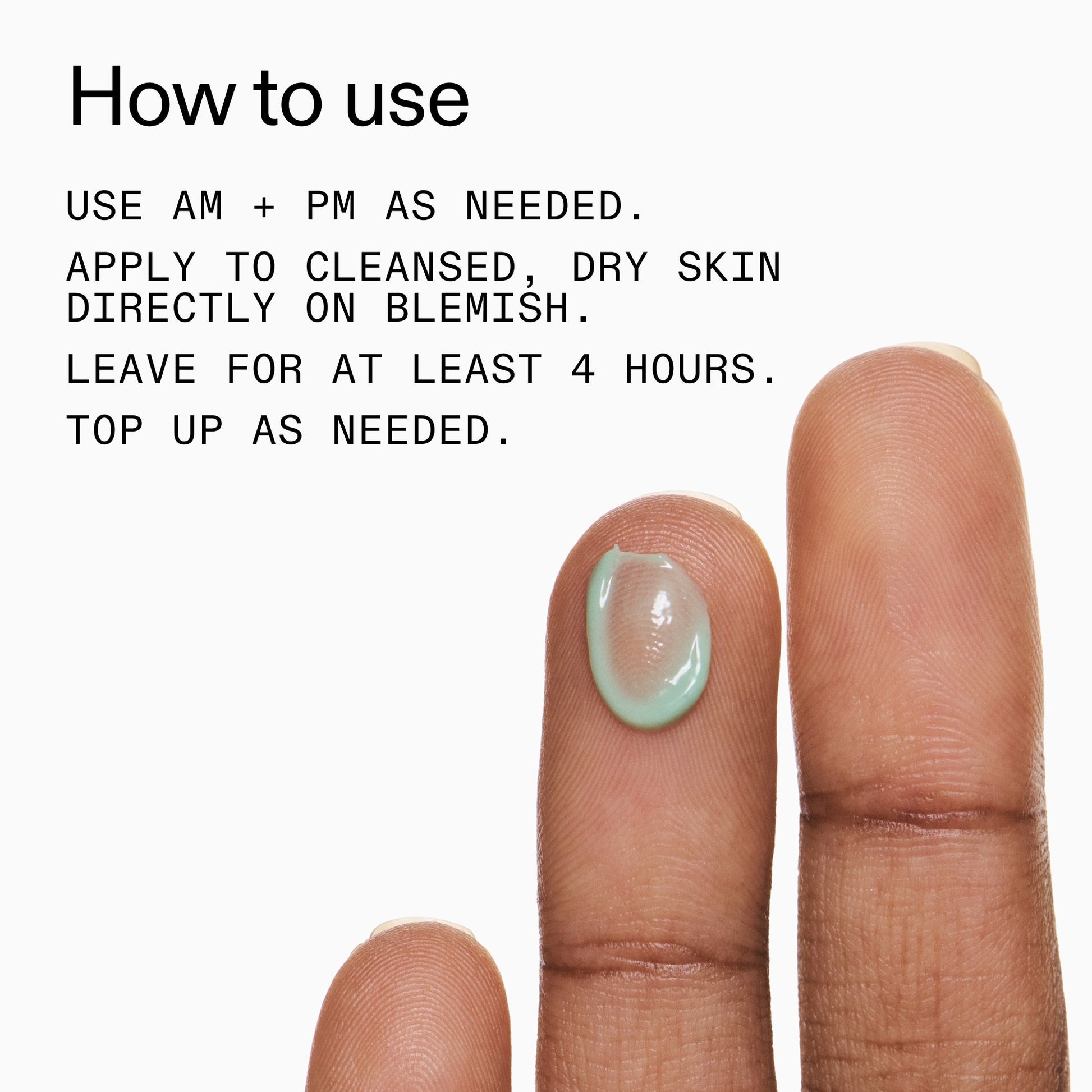 succinic-acid-acne-treatment-t3 Succinic_Acid_Treatment_How_to_Use_2000x2000_d57137d5-d7f1-427c-9a46-5fc00c19c542.jpg