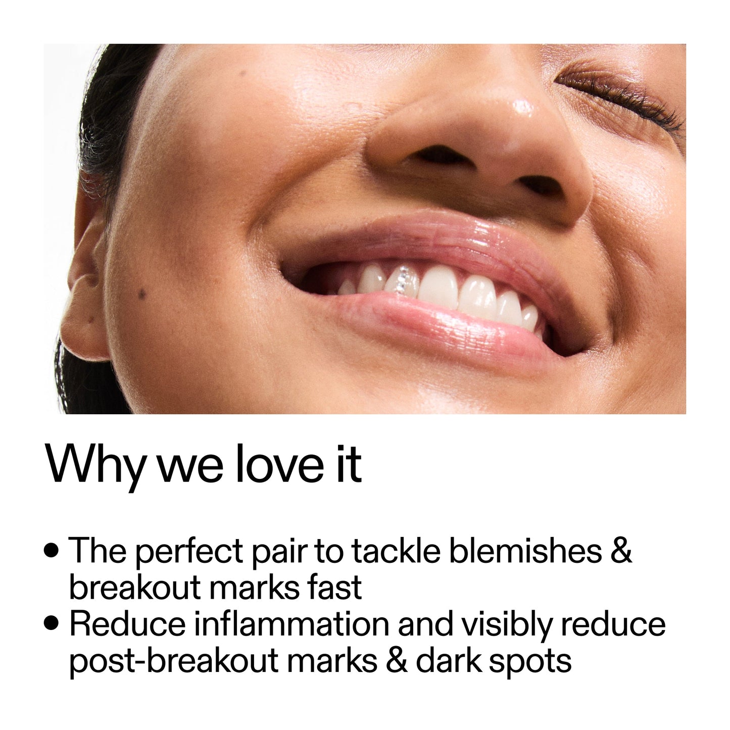targeted-blemish-duo-i6 Targeted_Blemish_Duo_Why_we_love_it_2000x2000_ff00be46-438b-485f-b5c3-91e60bbb6919.jpg