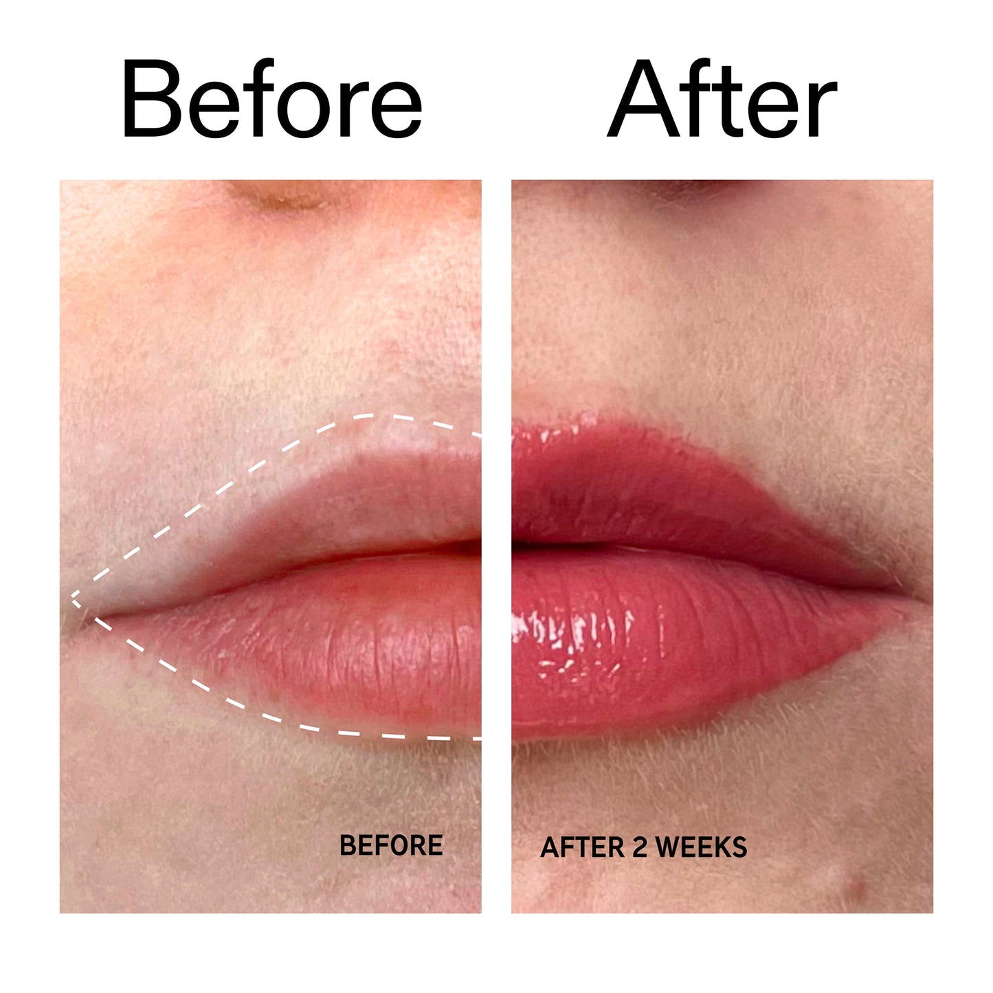 tripeptide-plumping-berry-lip-balm-r4 Tripeptide_Plumping_Lip_Balm_-_Berry_Before_After_2000x2000_9474bbd8-43ca-4b0e-b0e7-dfab70b91927.jpg