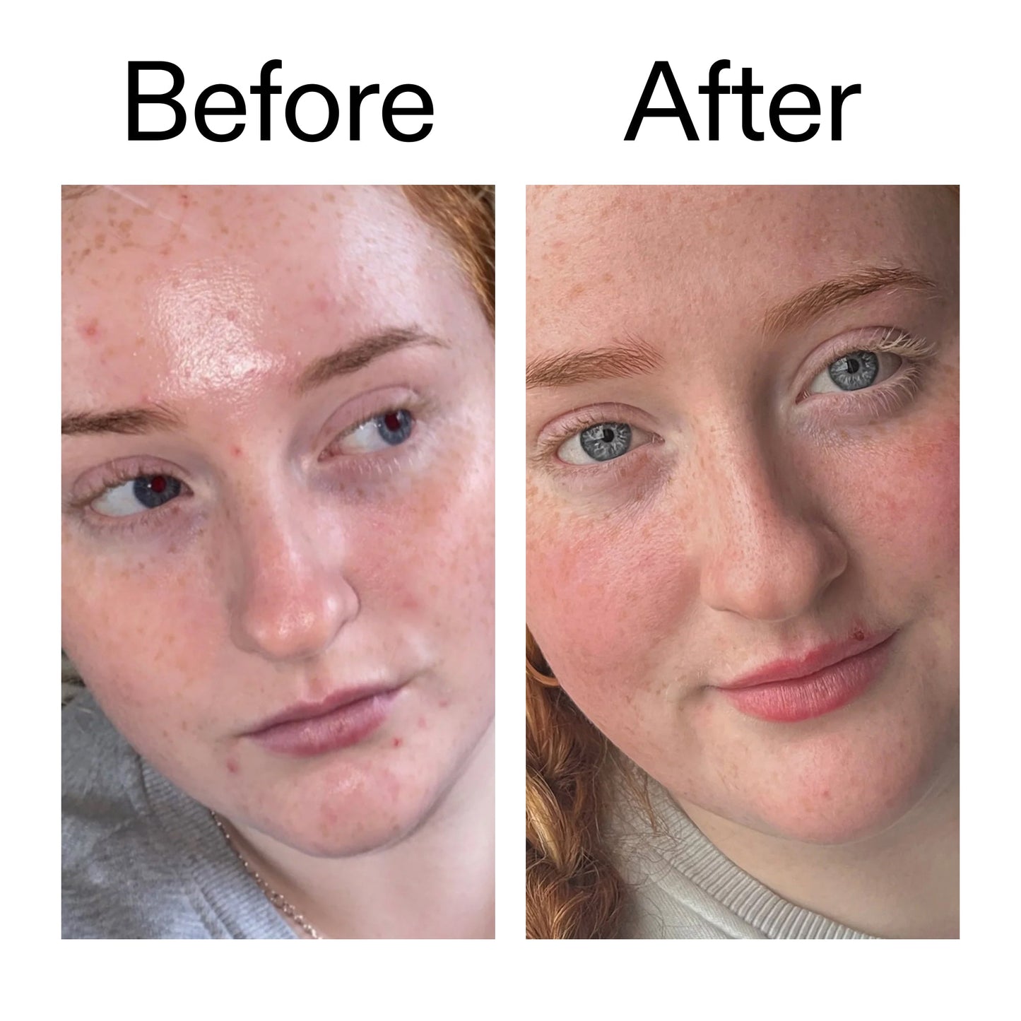vitamin-b-c-and-e-moisturizer-t5 Vitamin_B_C_and_E_Moisturizer_Before_After_2000x2000_b0781a76-5ad2-4be9-95b8-ef92b356833c.jpg